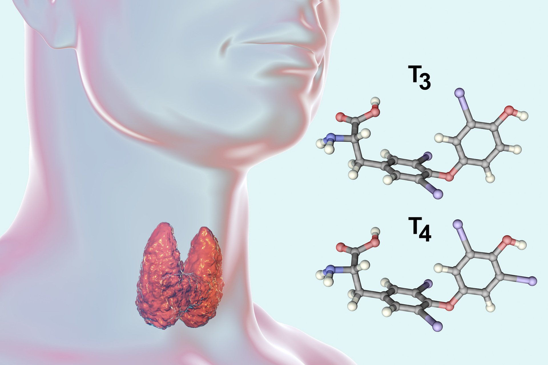 1,甲状腺结节4a; 2,甲状腺球蛋白抗体,甲状腺过氧化物酶抗体升高