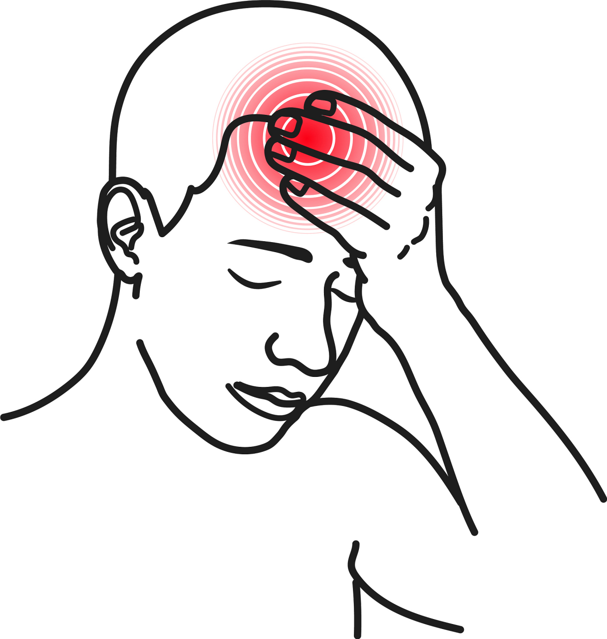 偏头痛是一种常见的神经系统疾病,其特点是剧烈,周期性的头痛发作常 