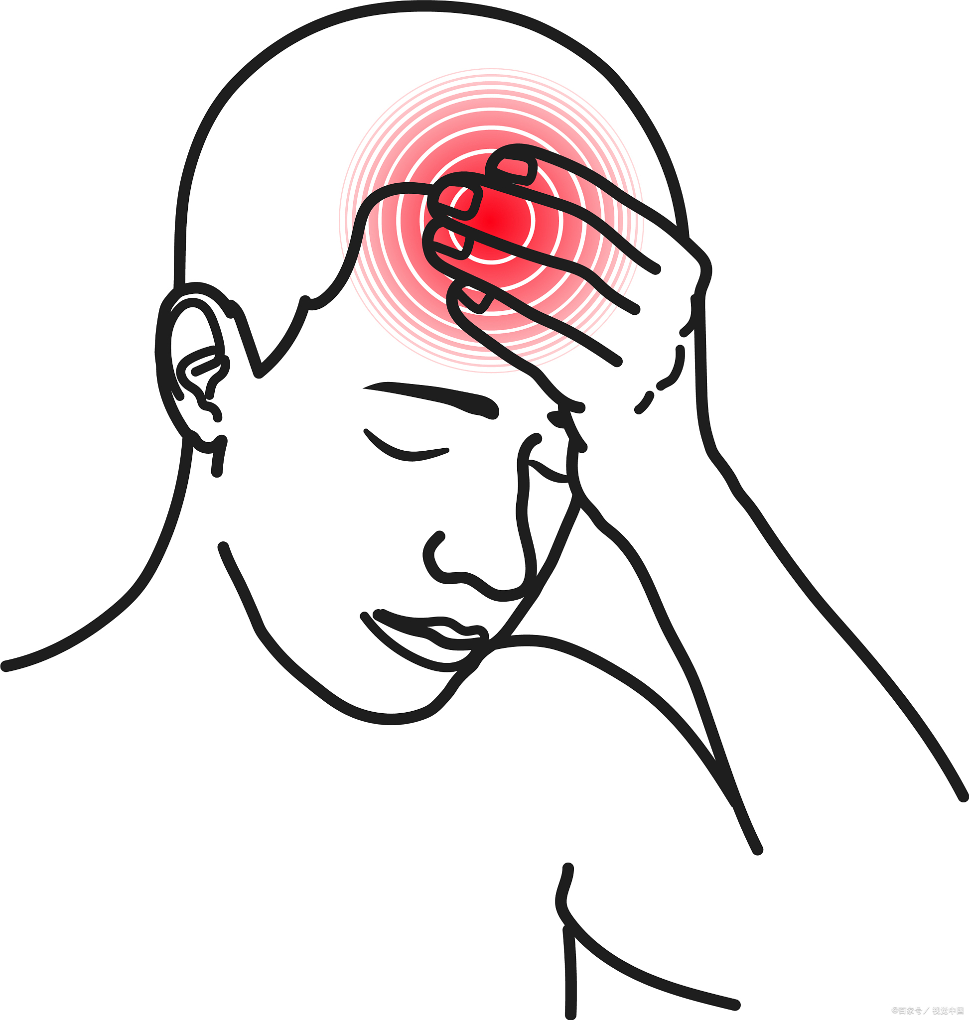 揪出根源,轻松止痛 偏头痛发作起来,真的让人难以忍