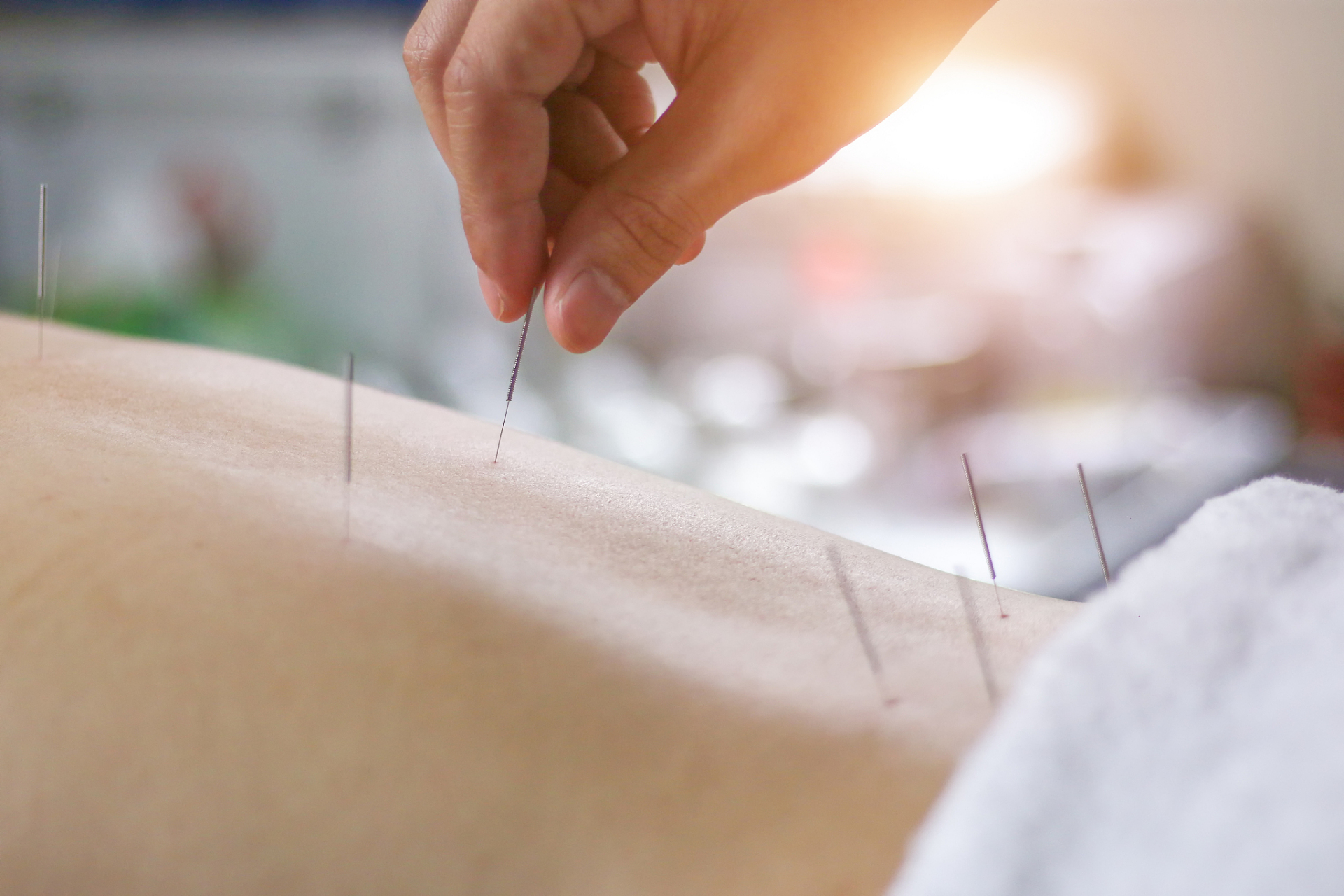 我深知针灸作为传统中医疗法,对于缓解这两种病症有着显著效果.