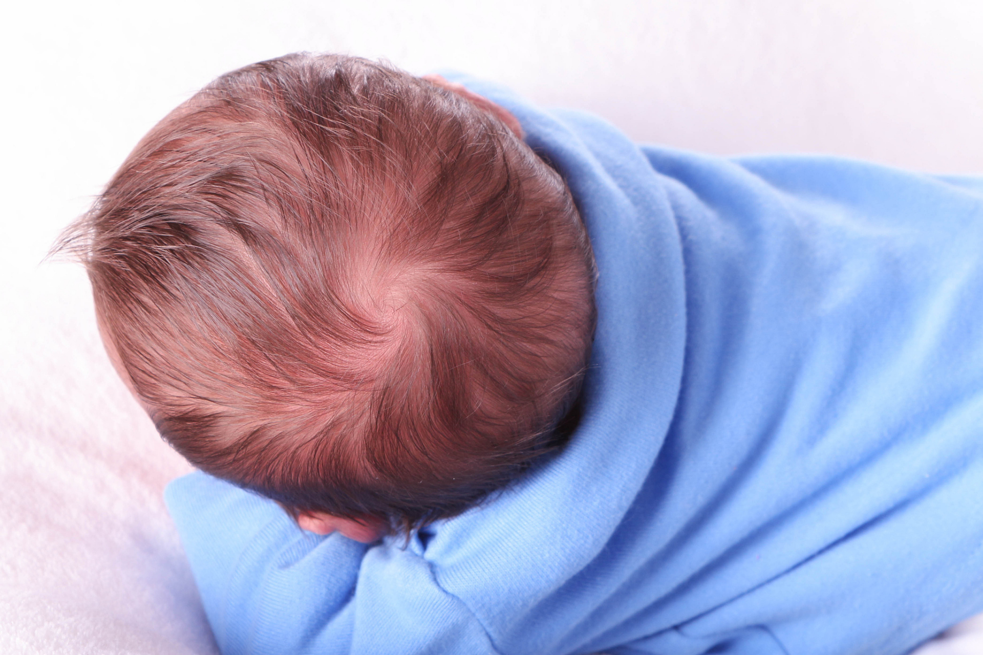 【宝宝秃枕,要不要补钙?】  哈哈!