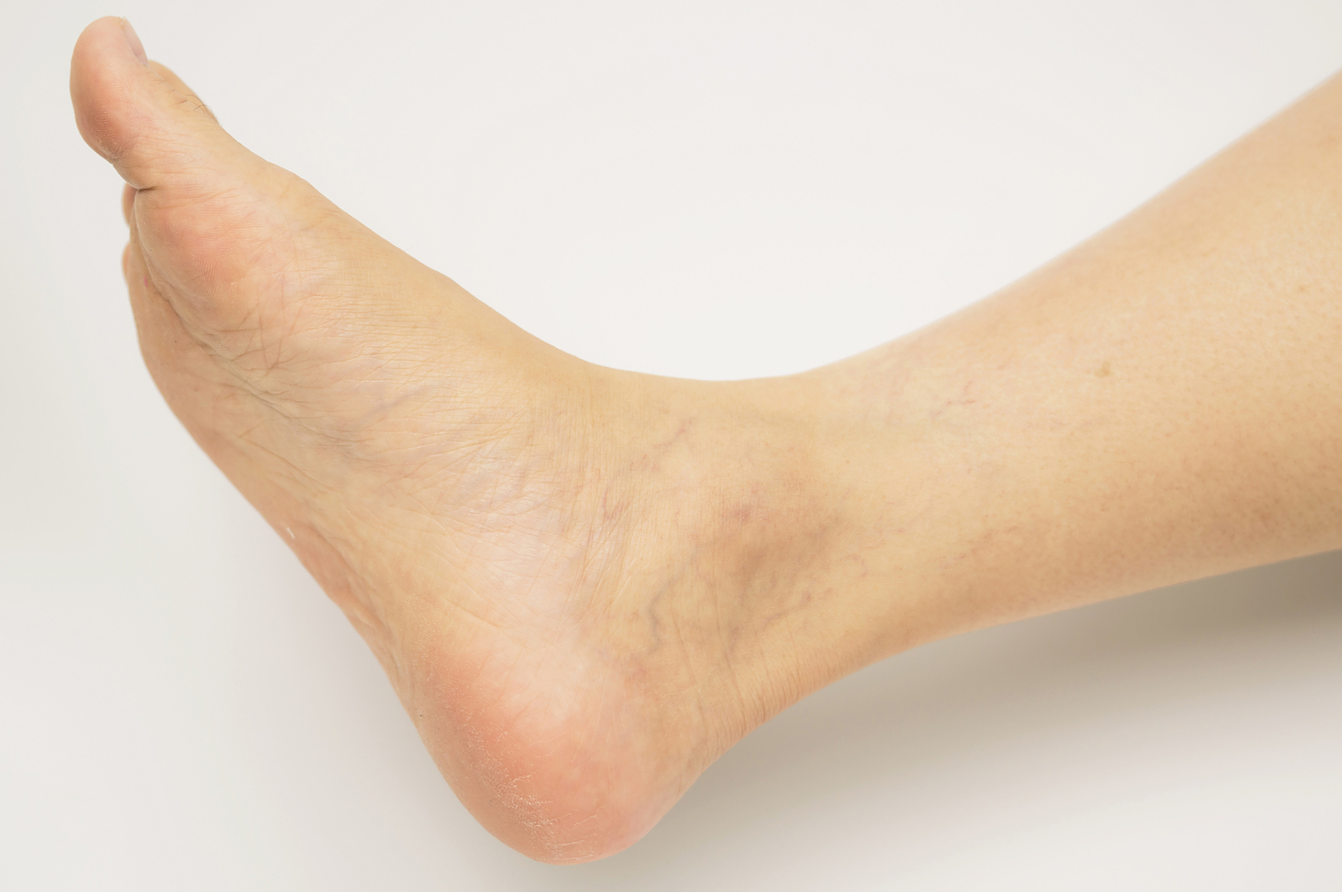 太溪穴   位置:脚内踝正后方凹陷中.