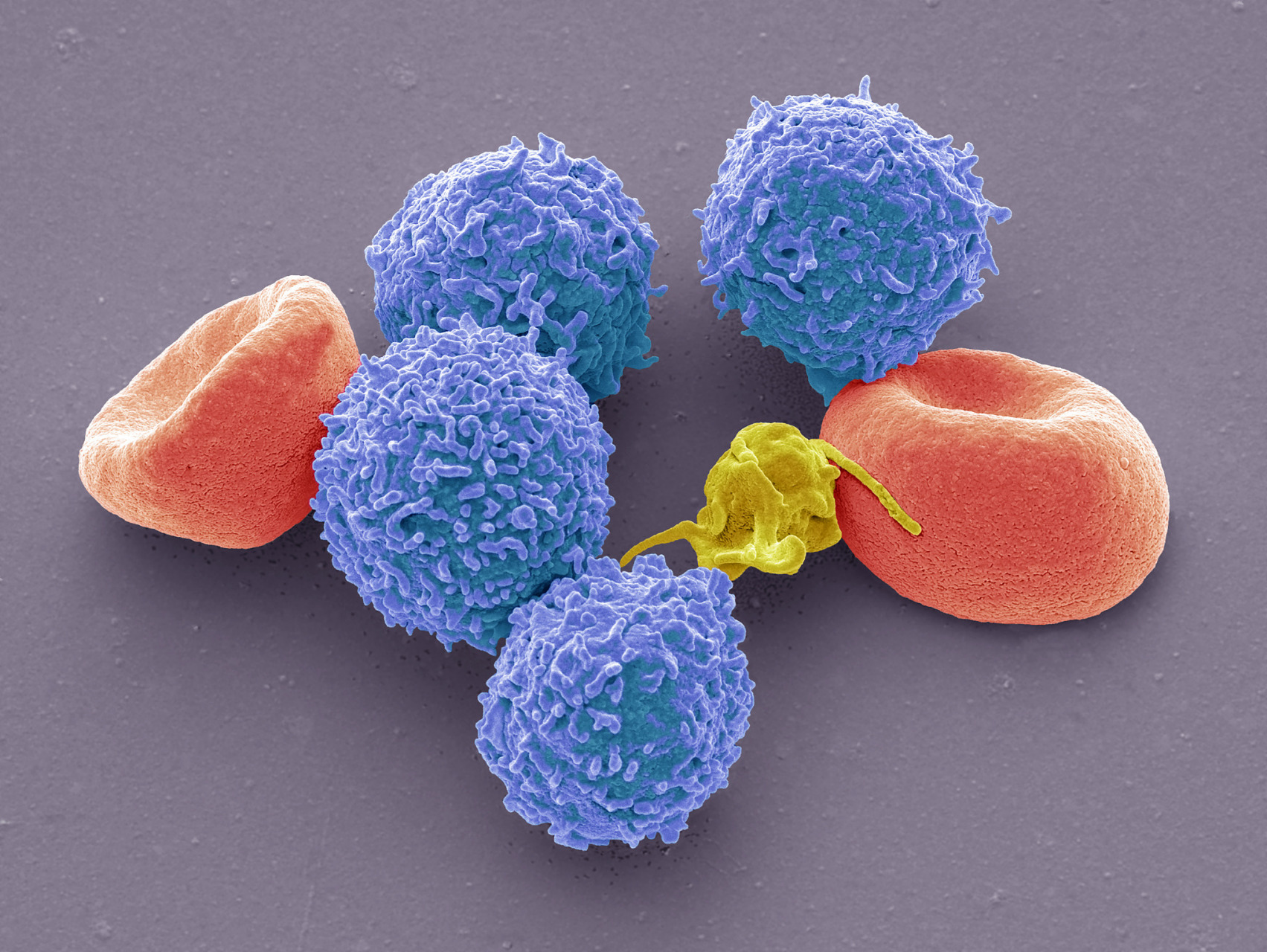 收假第一天# nk细胞(自然杀伤细胞)是一种重要的免疫细胞,也是人体的