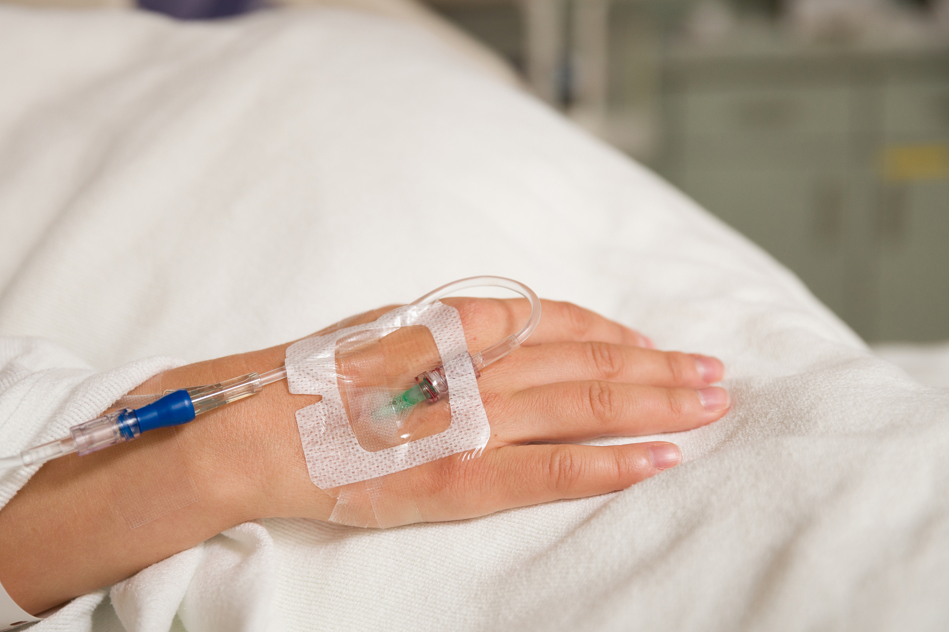 一截断留的留置针软管如何被发现?