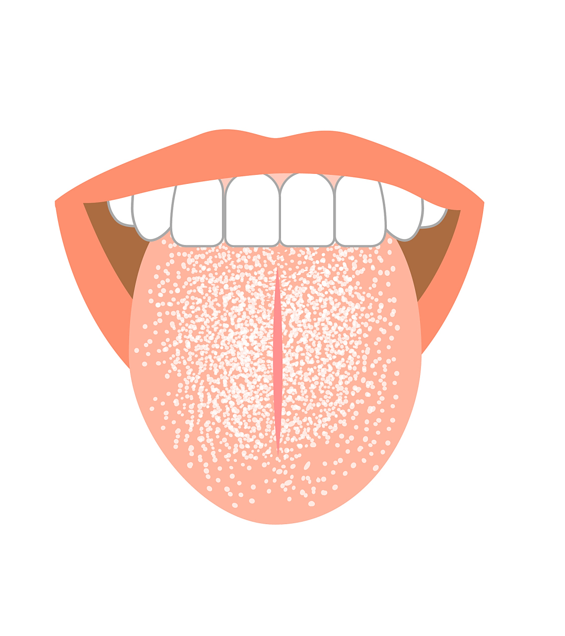 早晨看舌苔,疾病都躲开,看看你是哪一种? 起床后呢,我们可以照一照镜