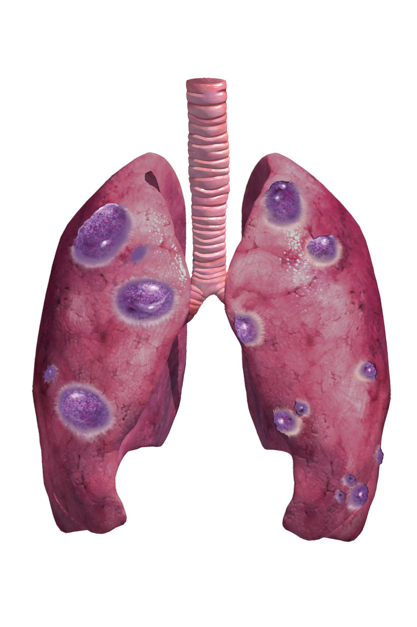 起来了,它的果期就在4月-7月,现在就可以采摘用来泡水喝或者煲汤喝了