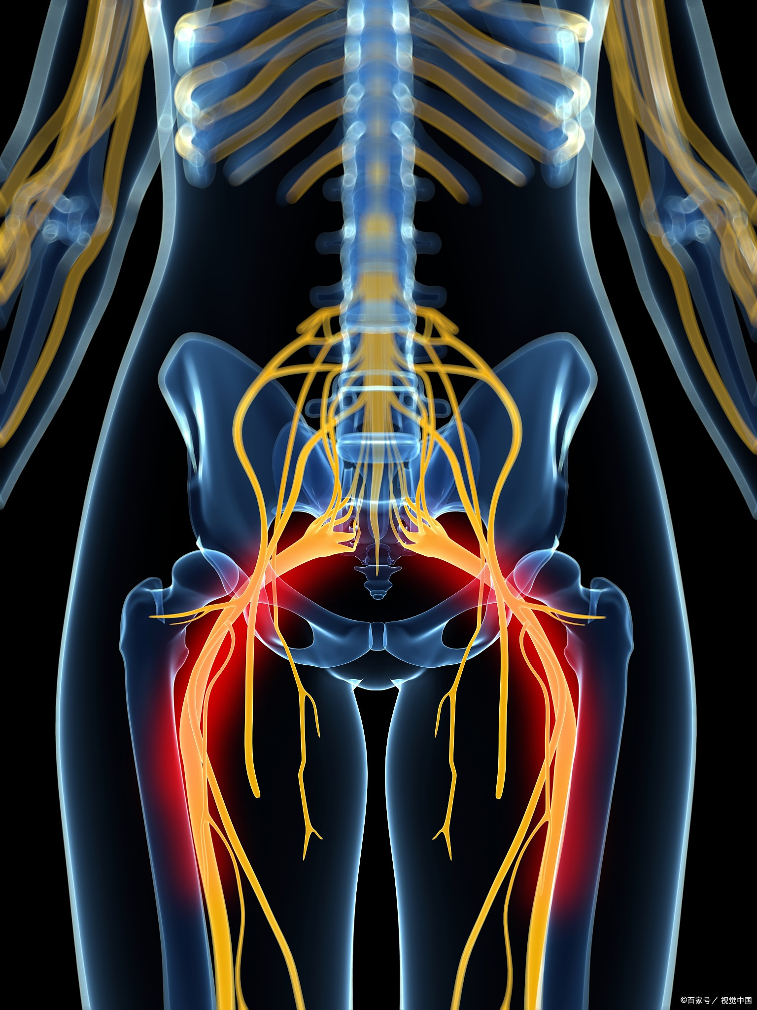 坐骨神经疼的部位图图片