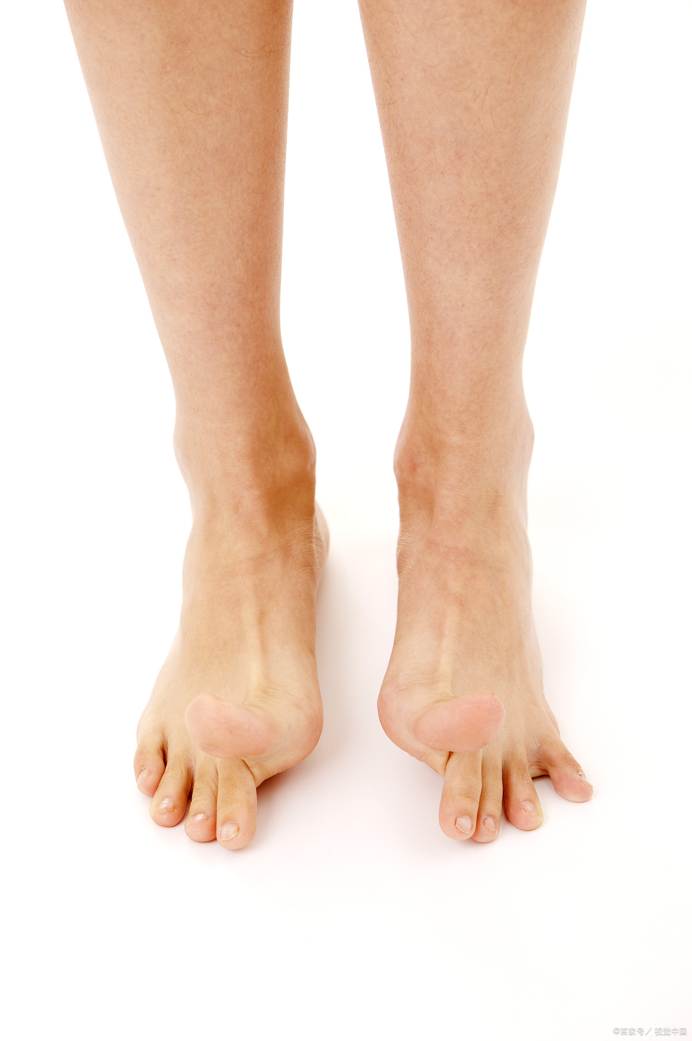 总摔跤,试试这些改善方法