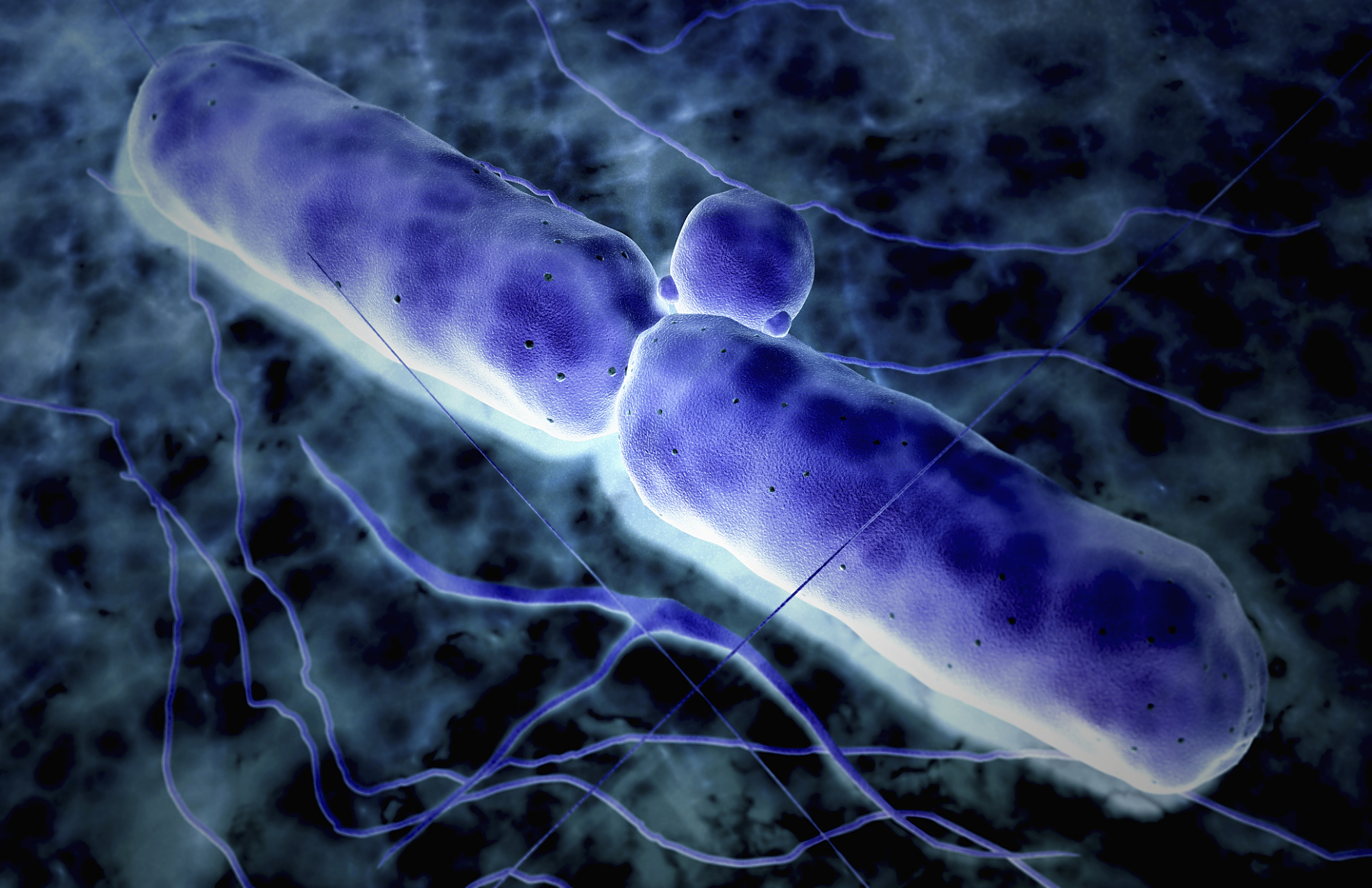 俄罗斯政府宣布全国进入细菌性炭疽病紧急状态,原因是俄罗斯远东地区