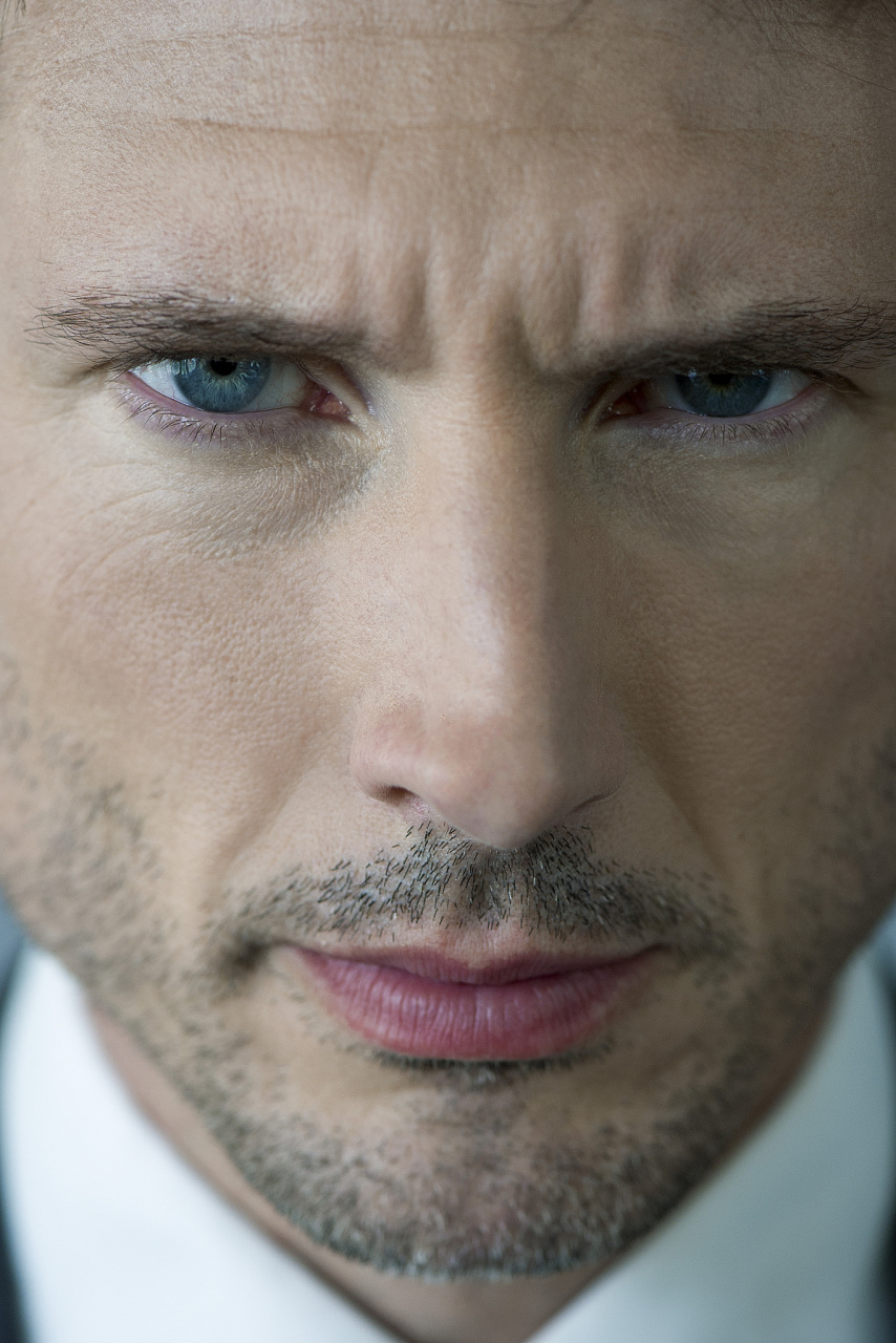 眉心处的皱纹通常是由于表情肌肉活动和皮肤衰老引起的.