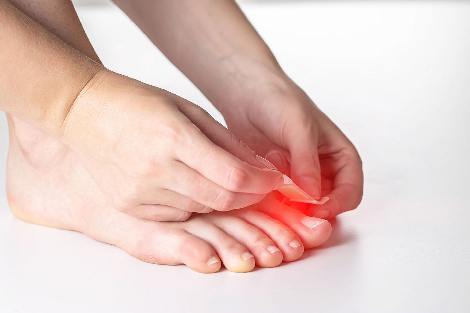 痛风脚拇趾关节一直肿痛,可以在医生指导下采取物理治疗,药物治疗的