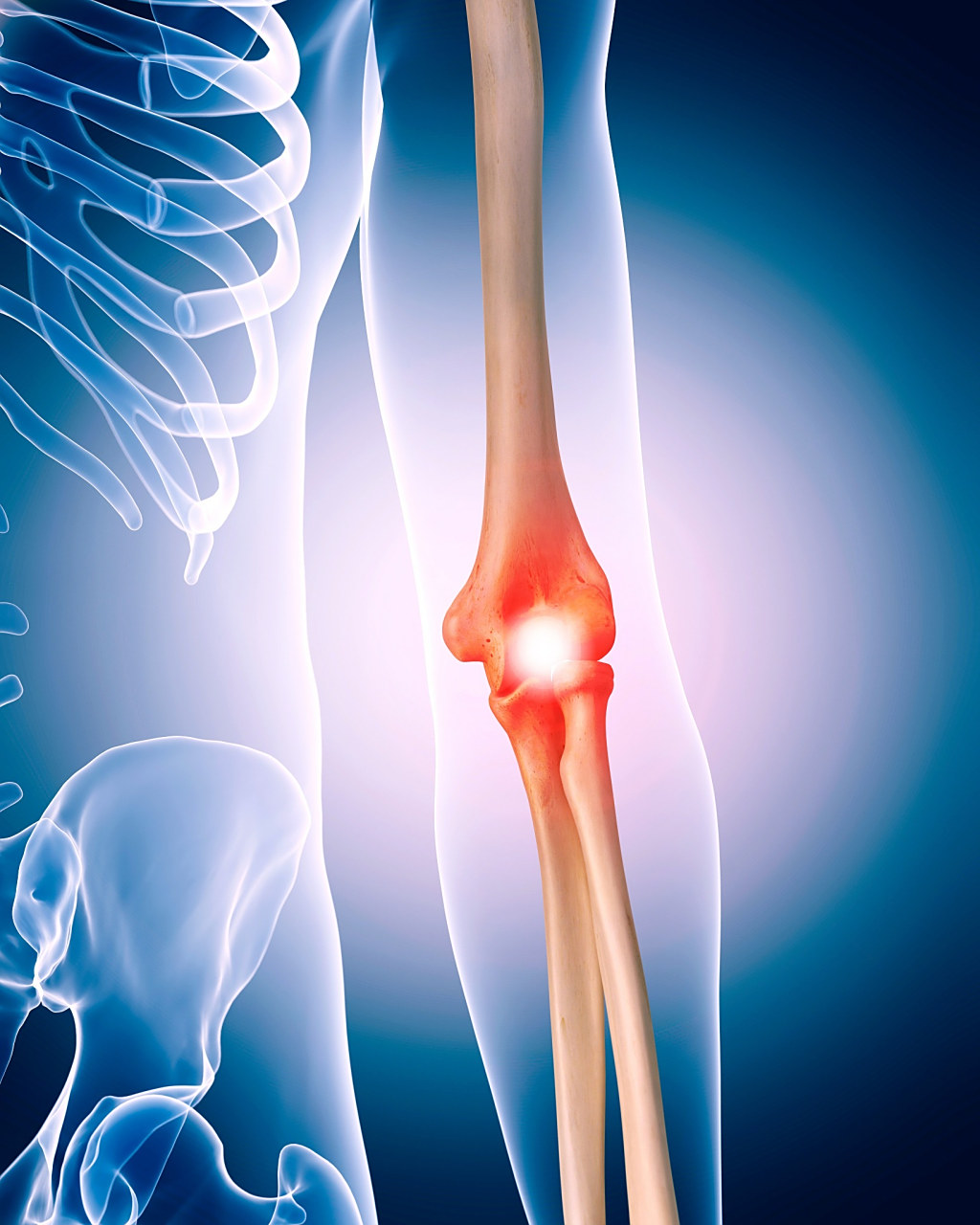 骨性膝关节炎是什么原因引起的?