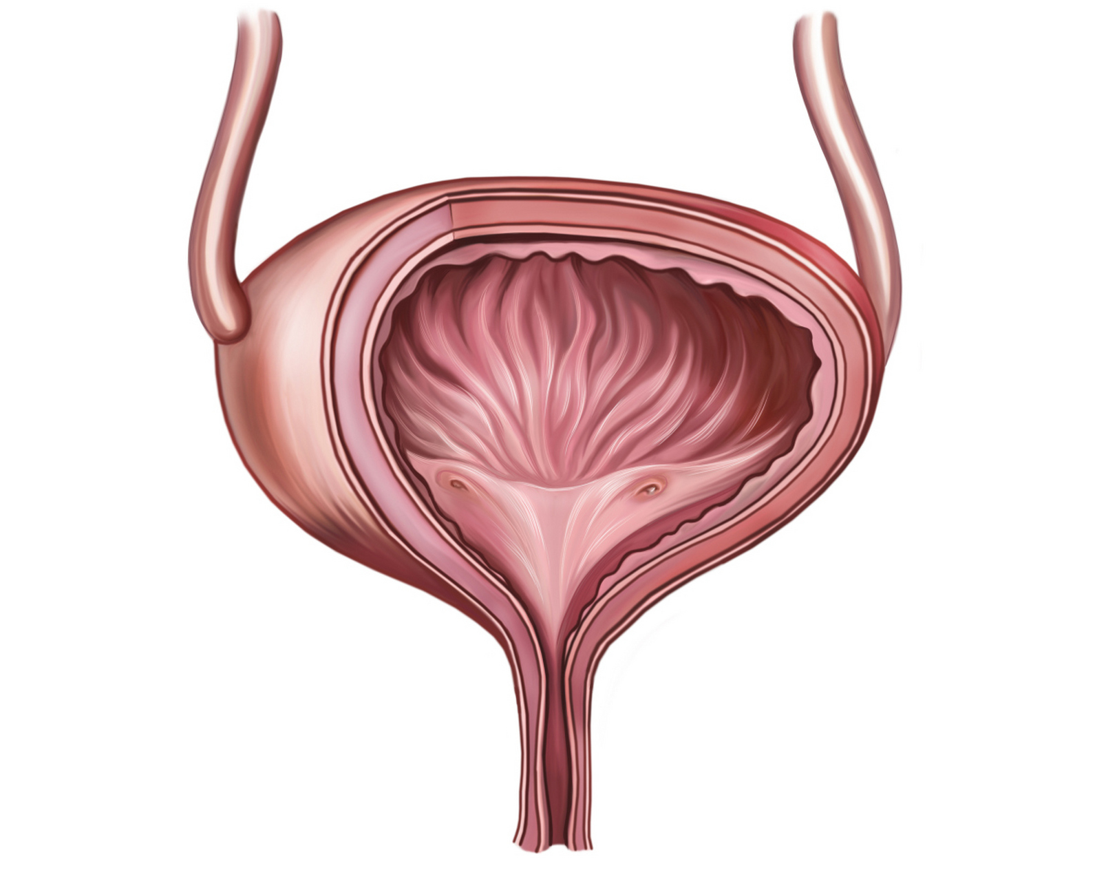随着尿液的增加,膀胱逐渐充盈膨胀.