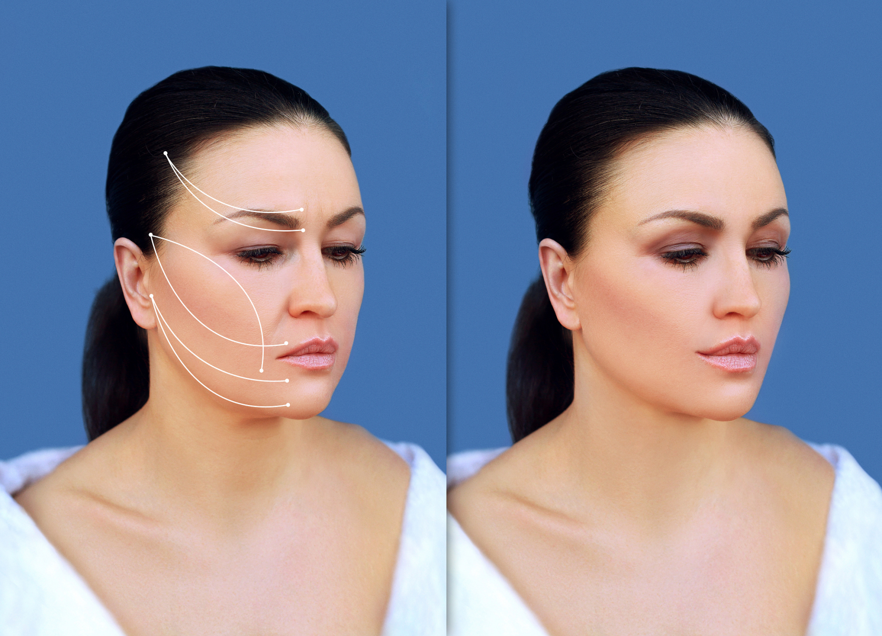 重塑面部轮廓:精准美学,焕发自信光彩  面部轮廓整形,作为现代医疗