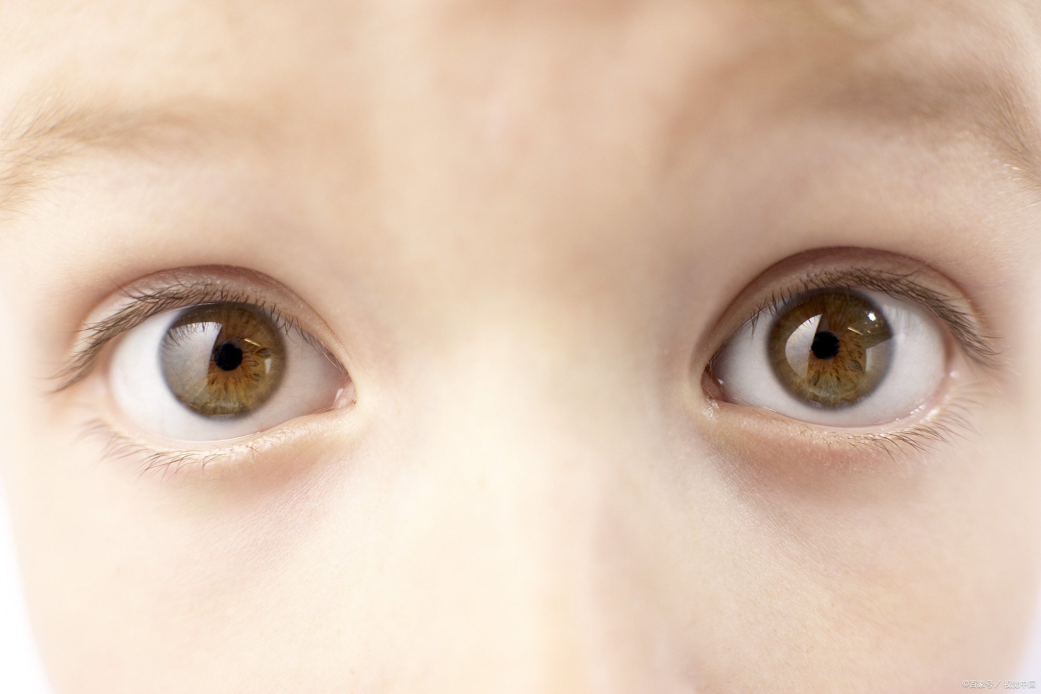 小孩子眼睛眨得很频繁是什么原因?孟青主任:注意这几种因素