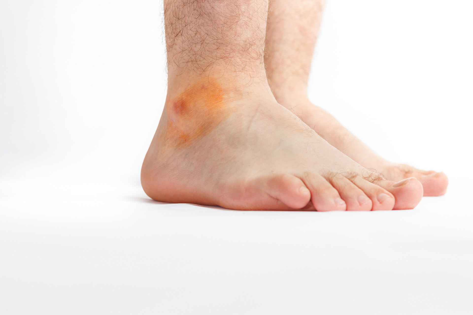 肾脏不好脚先知!