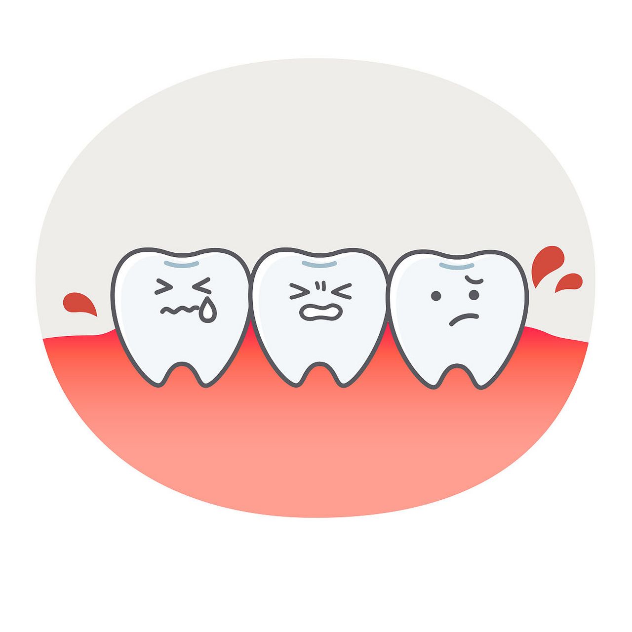 做好儿童牙龈炎的预防和治疗,远离牙龈炎  建立良好的口腔卫生习惯