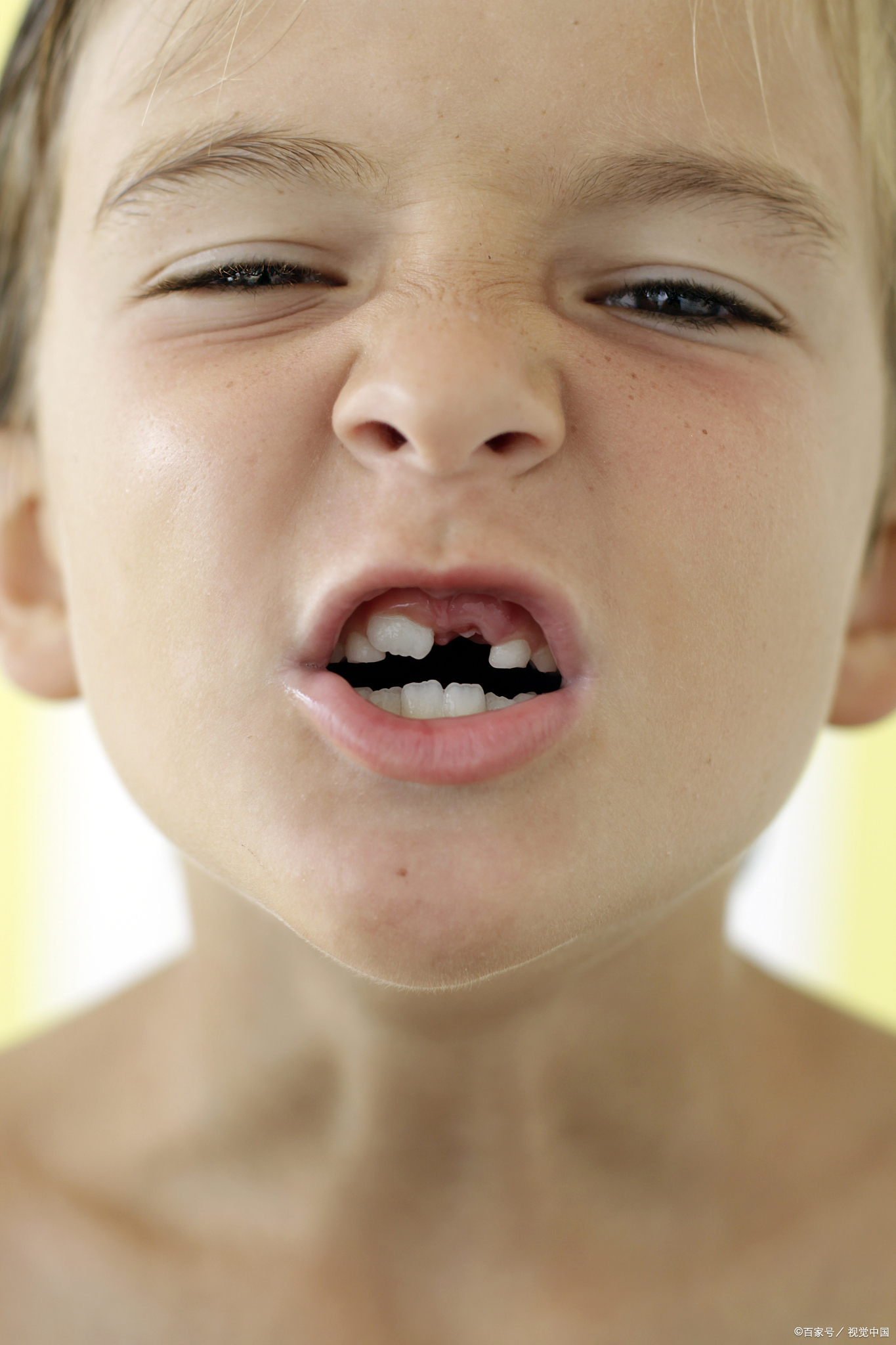 也不影小宝宝门牙断了图片牙没长好的小孩图片儿童门牙牙齿图片拔出来