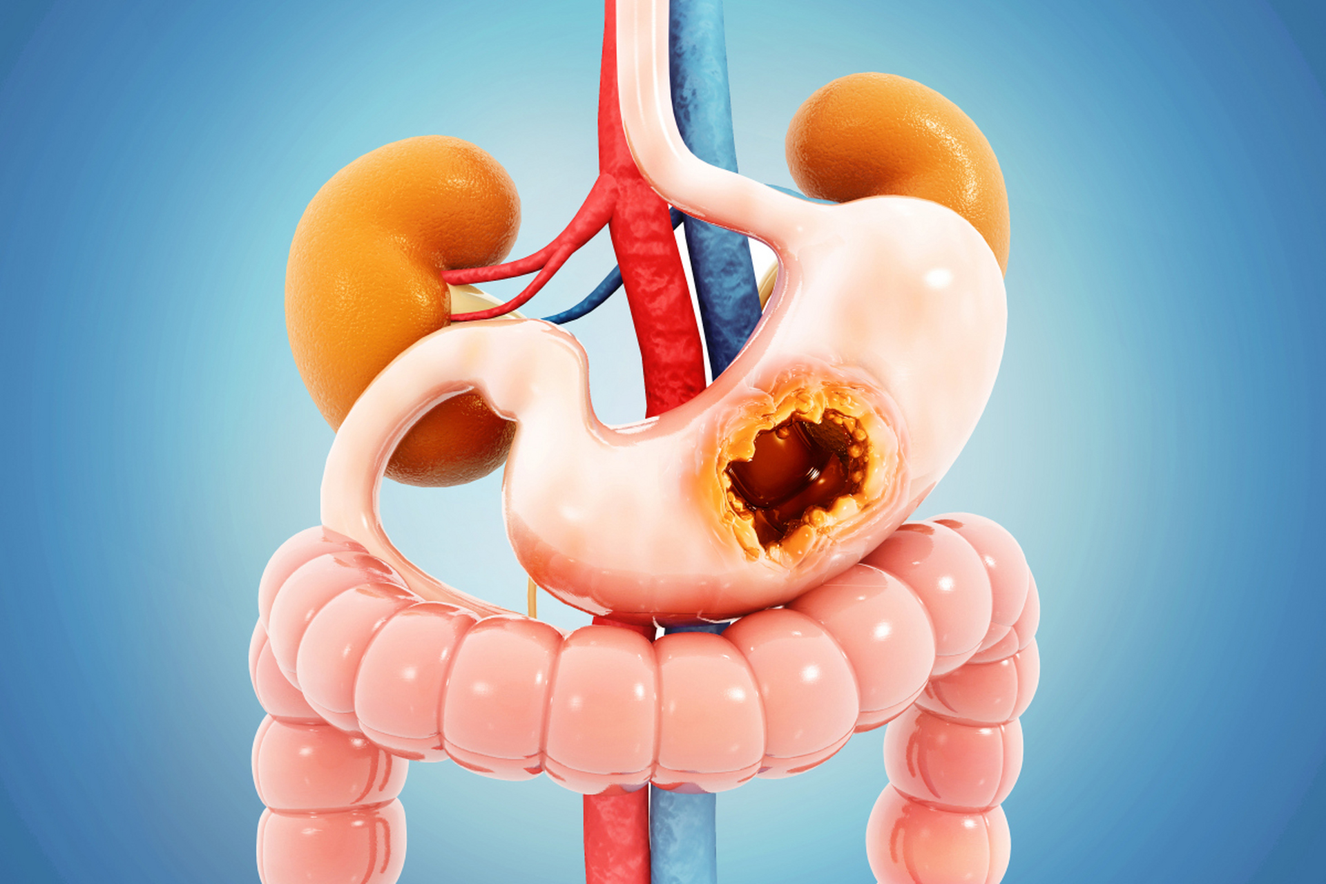 沈阳胃肠医院# 功能性胃肠疾病如何调理?