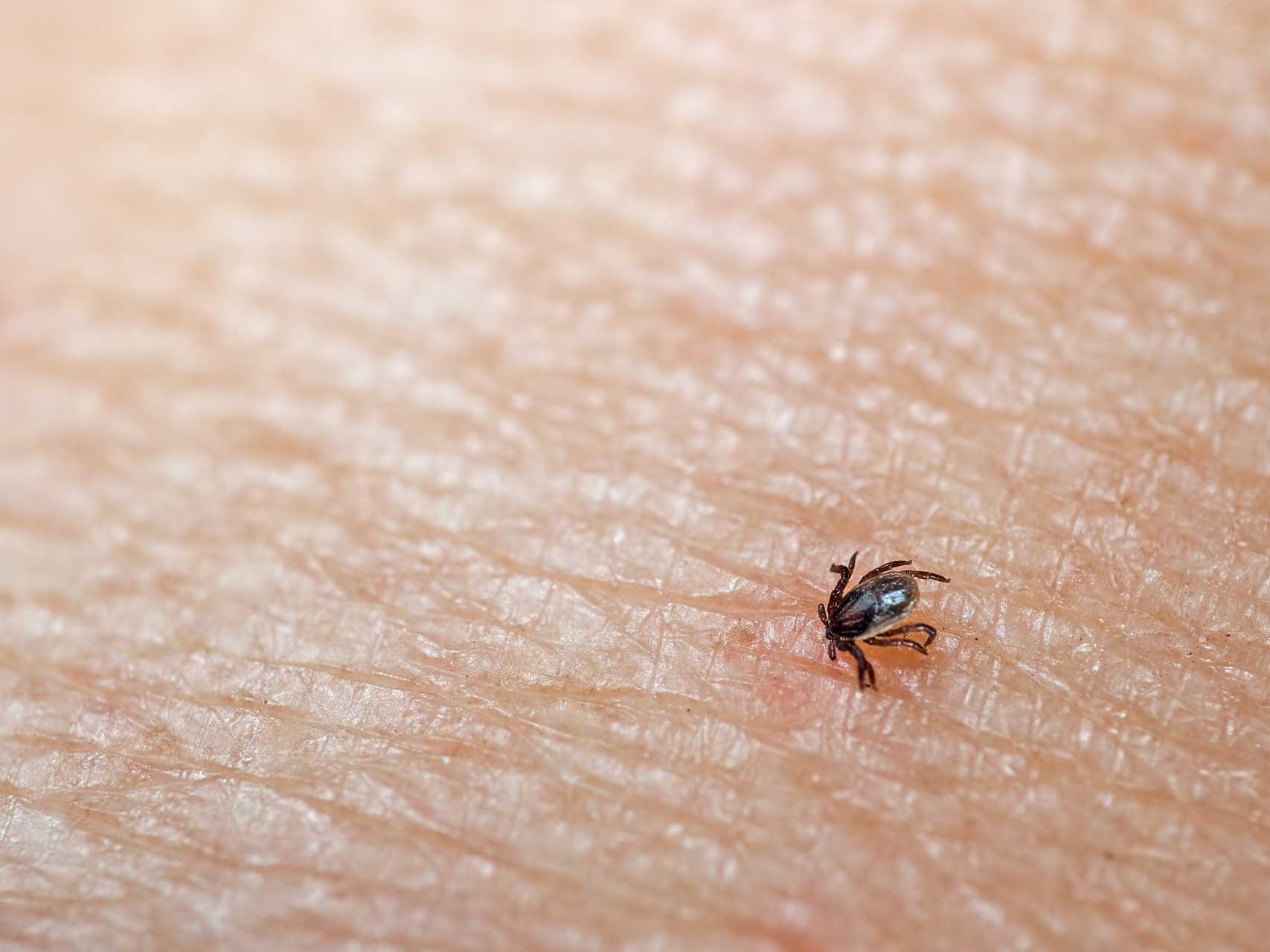 想知道跳蚤怎么做到350倍的跳跃?媲美人类飞跃整个橄榄球场!