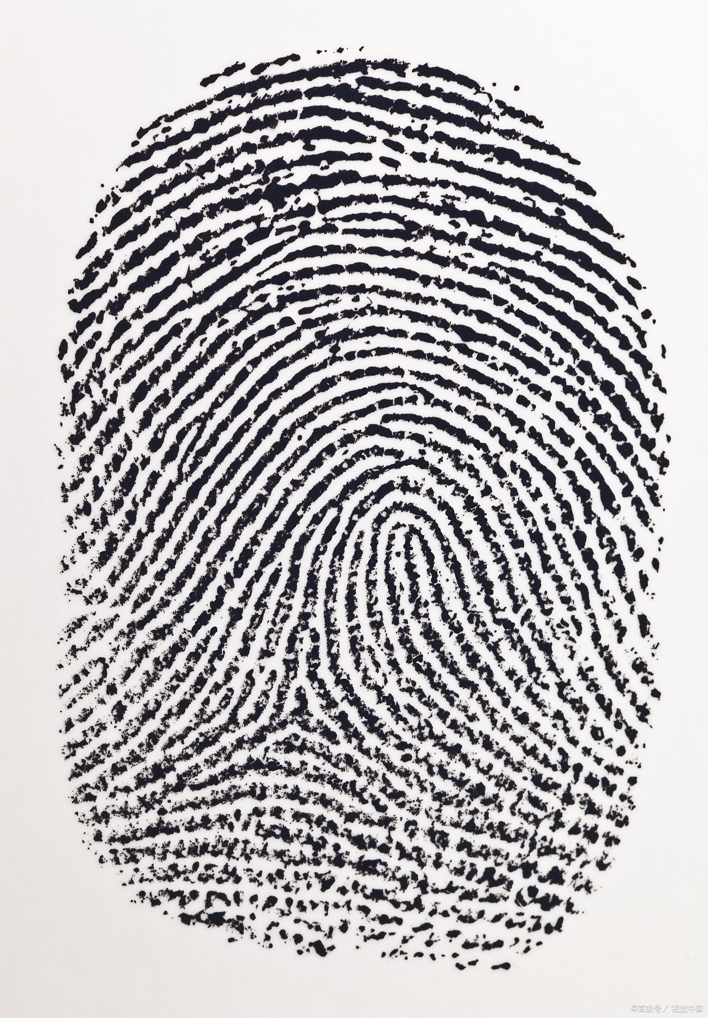 人体自带的超精密传感器