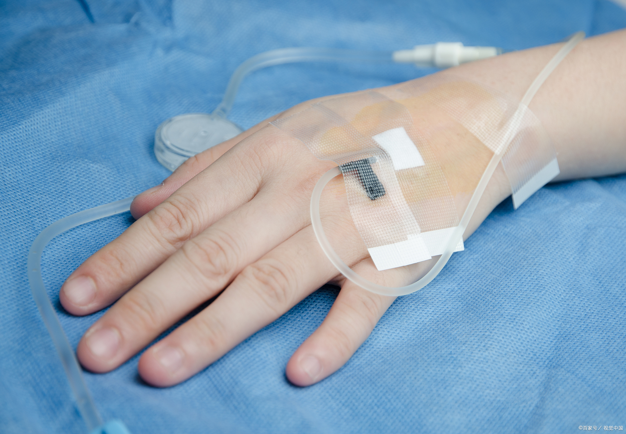 到第二家,输液三天,吃药三天,换了两回药吃,花了330块钱.