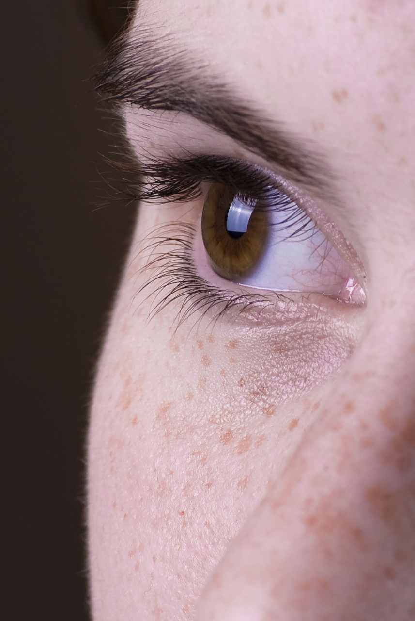 远离眼部泪斑的有效方法 #悦己爱眼季#  #激光祛斑#   泪斑是指出现在