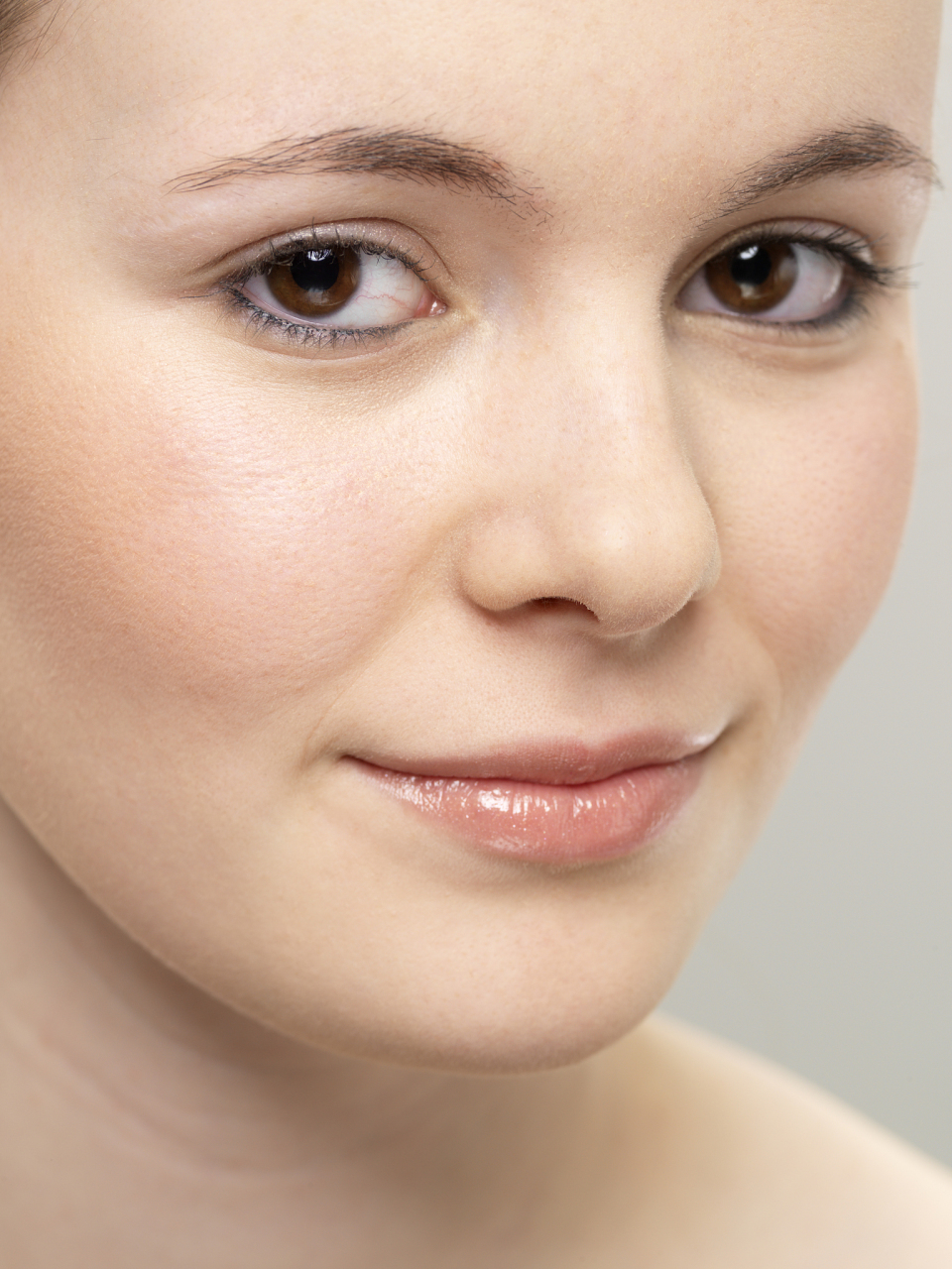 内眼角细纹可以考虑使用透明质酸填充剂来改善细纹,使用自体脂肪填充