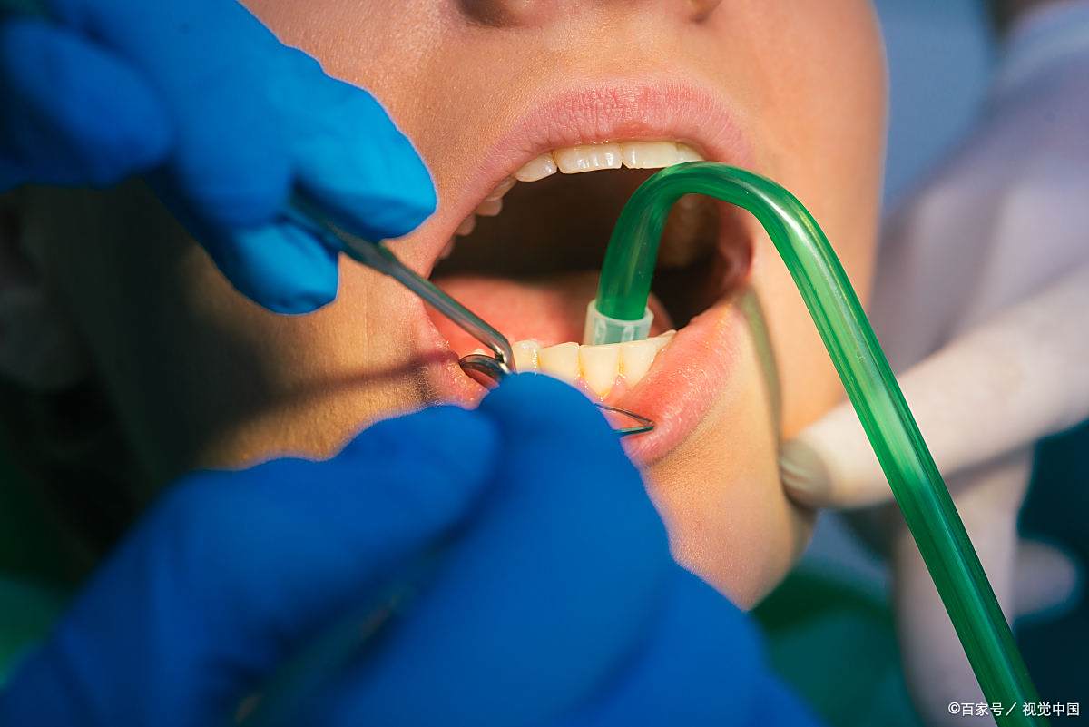 高血压为什么不能拔牙