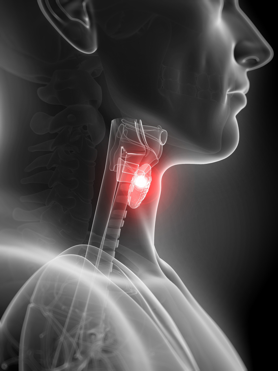 白云山冷敷甲状腺贴#  喉咙发炎的症状常包括疼痛,肿胀,咳嗽,发烧等.