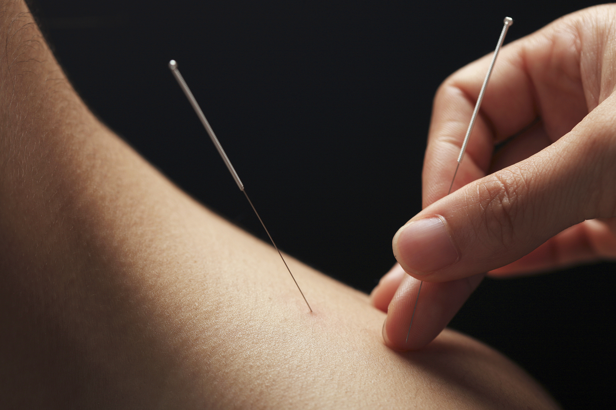 本文助你一臂之力,轻松报考,成就针灸师梦想!