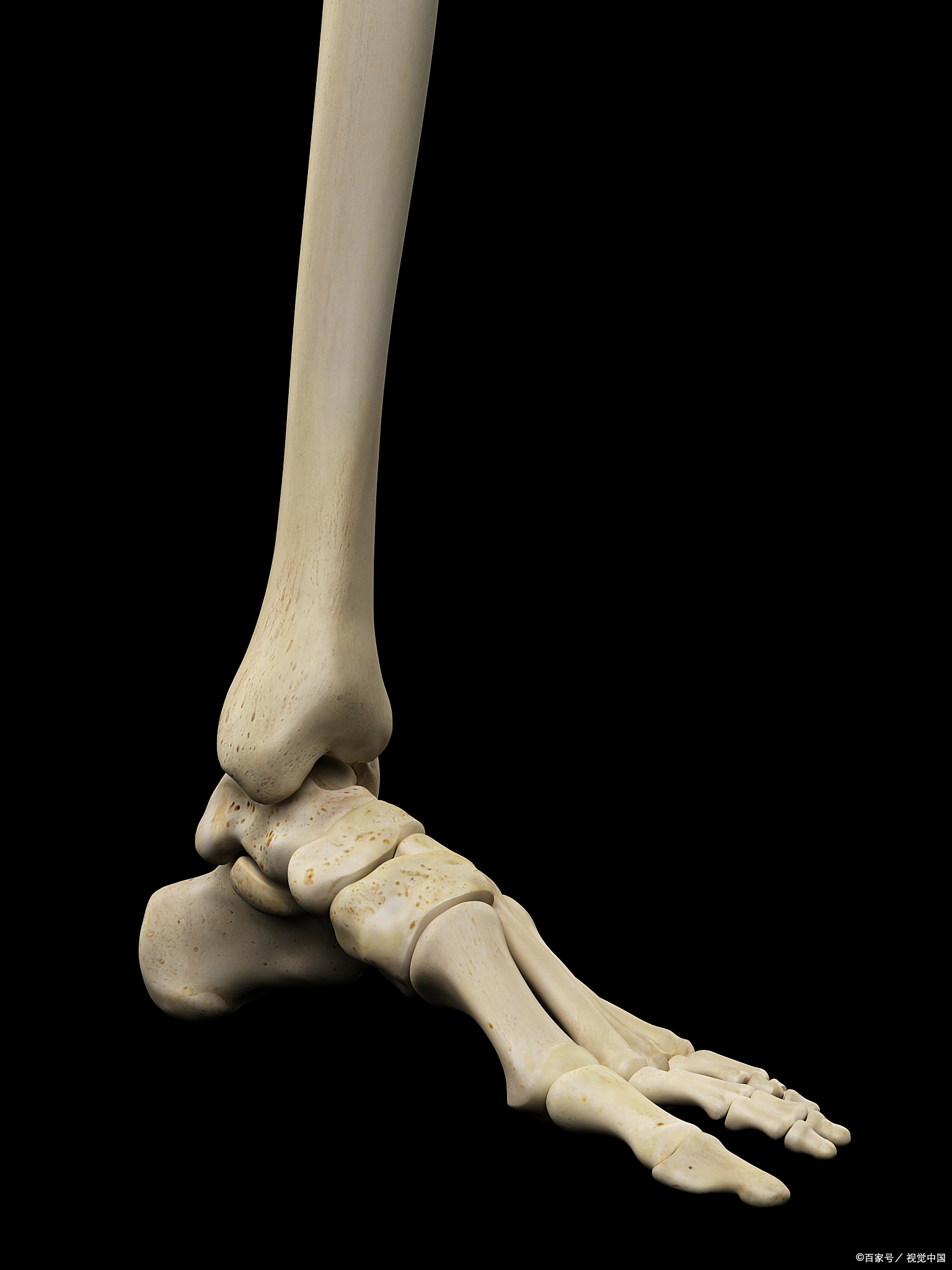 北京大脚骨该如何进行预防