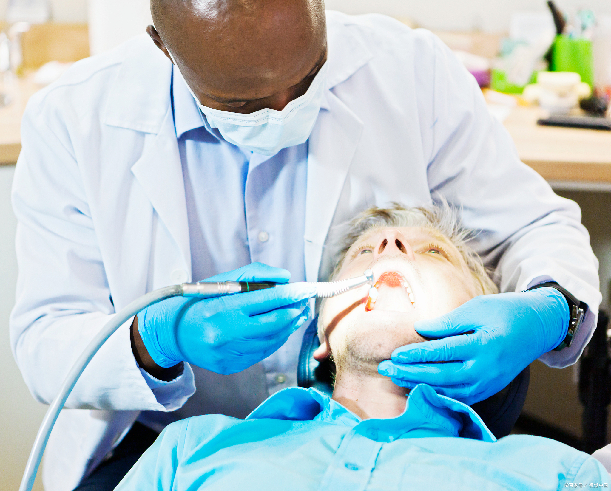 为什么要坚持洗牙?