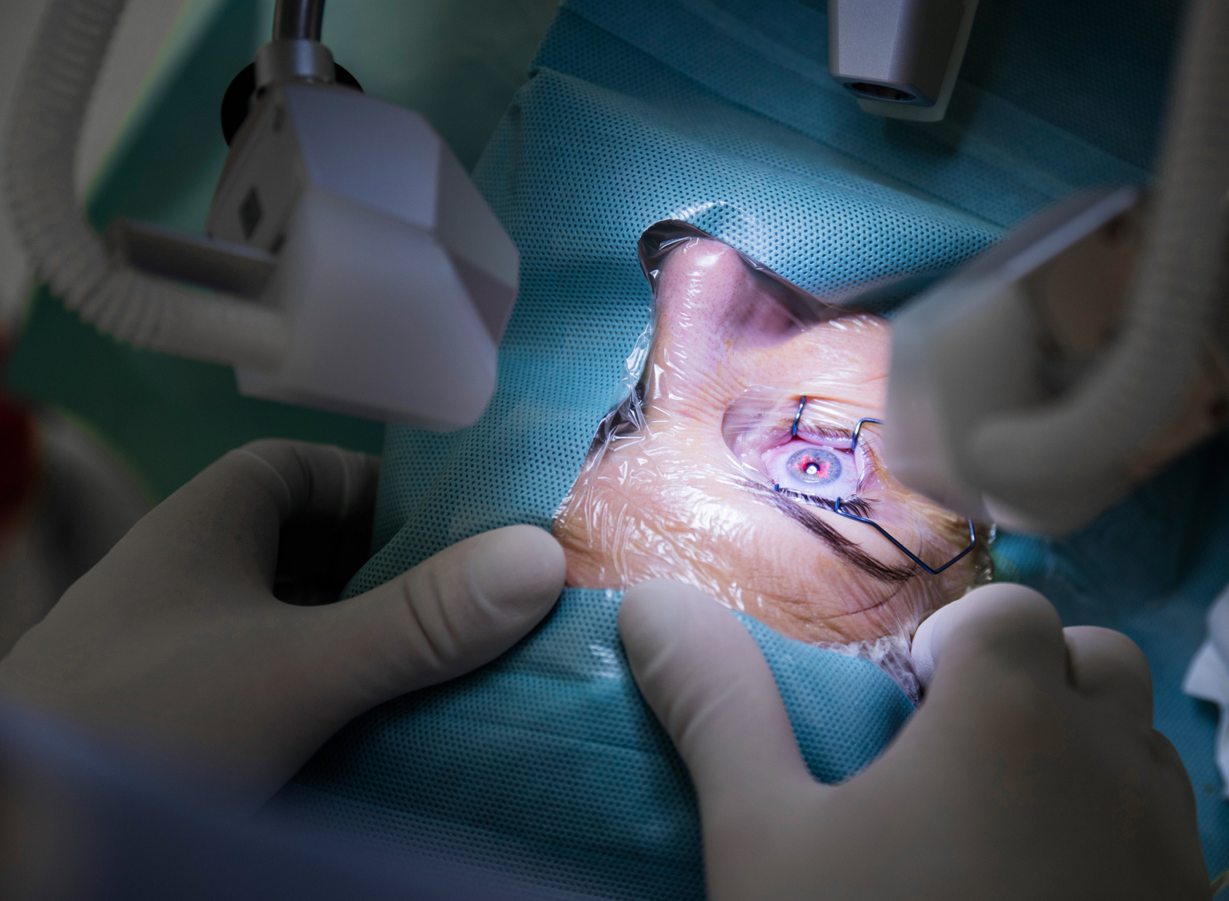 青少年做了斜视手术,护理重点你知道吗?