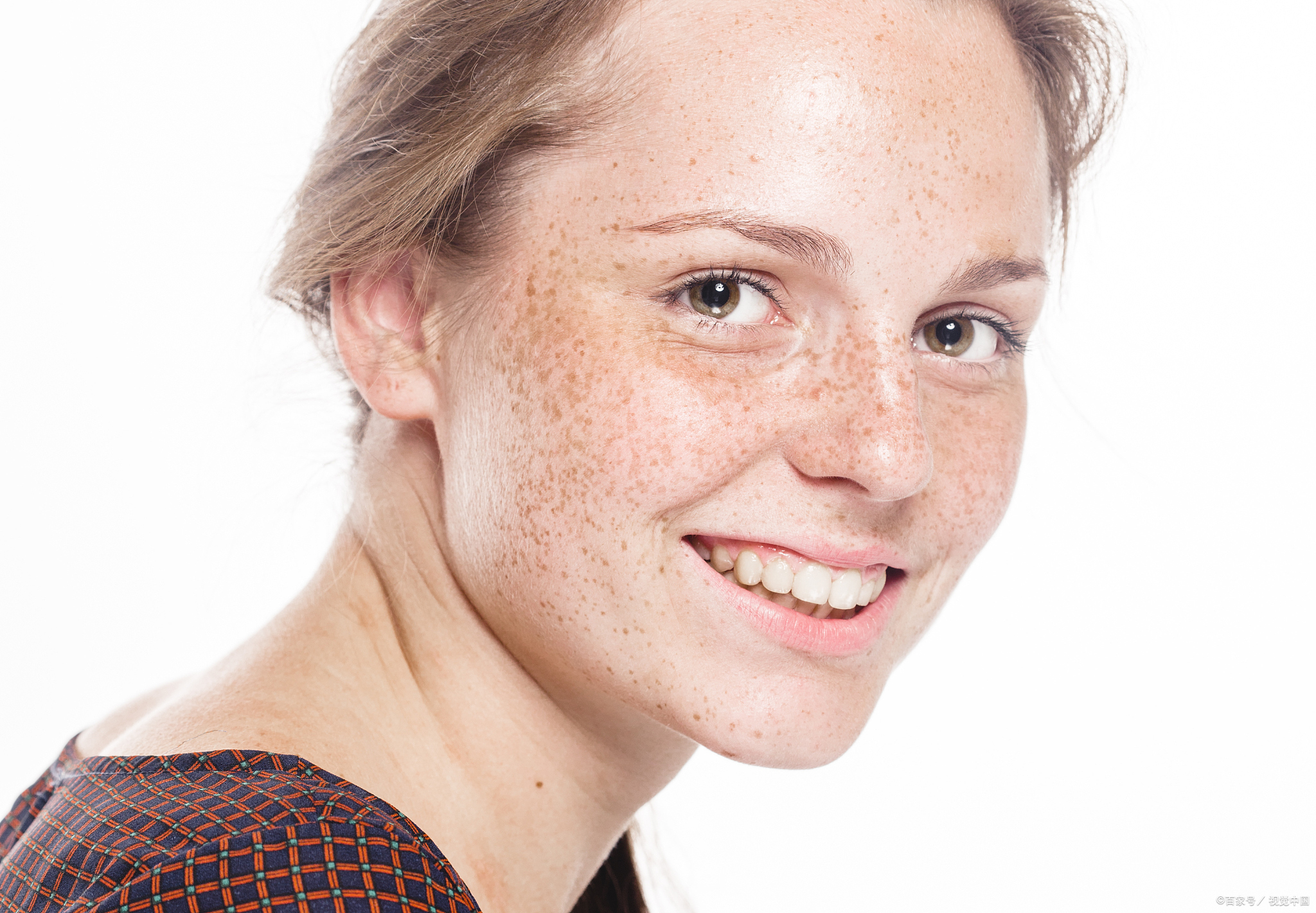 点完斑后的皮肤,如同经历了一场微型的战役,每一寸肌肤都在努力地