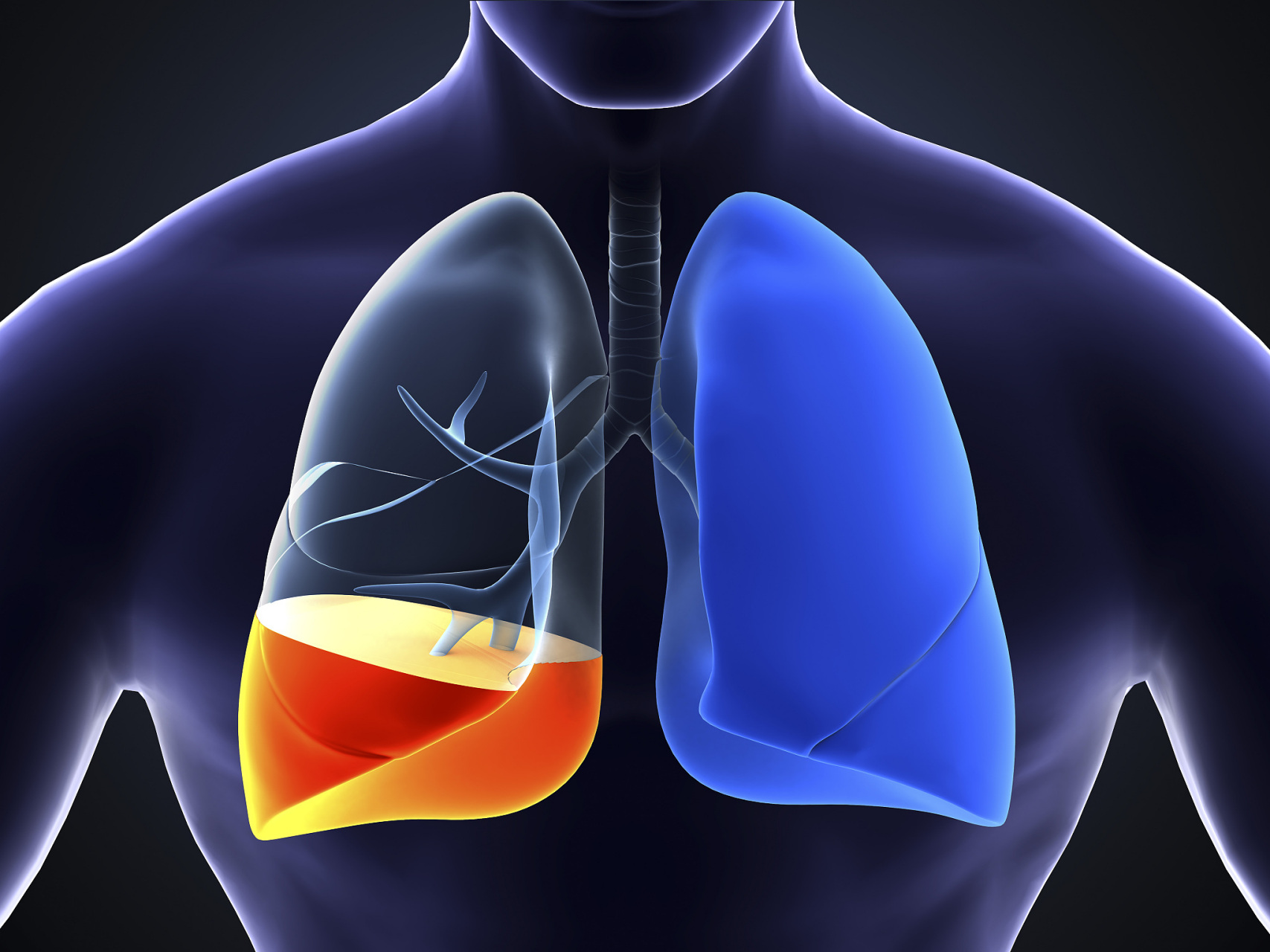 告诉大家一个治疗肺气肿的好消息,长期的咳嗽,咳痰,胸闷气短,四肢乏力