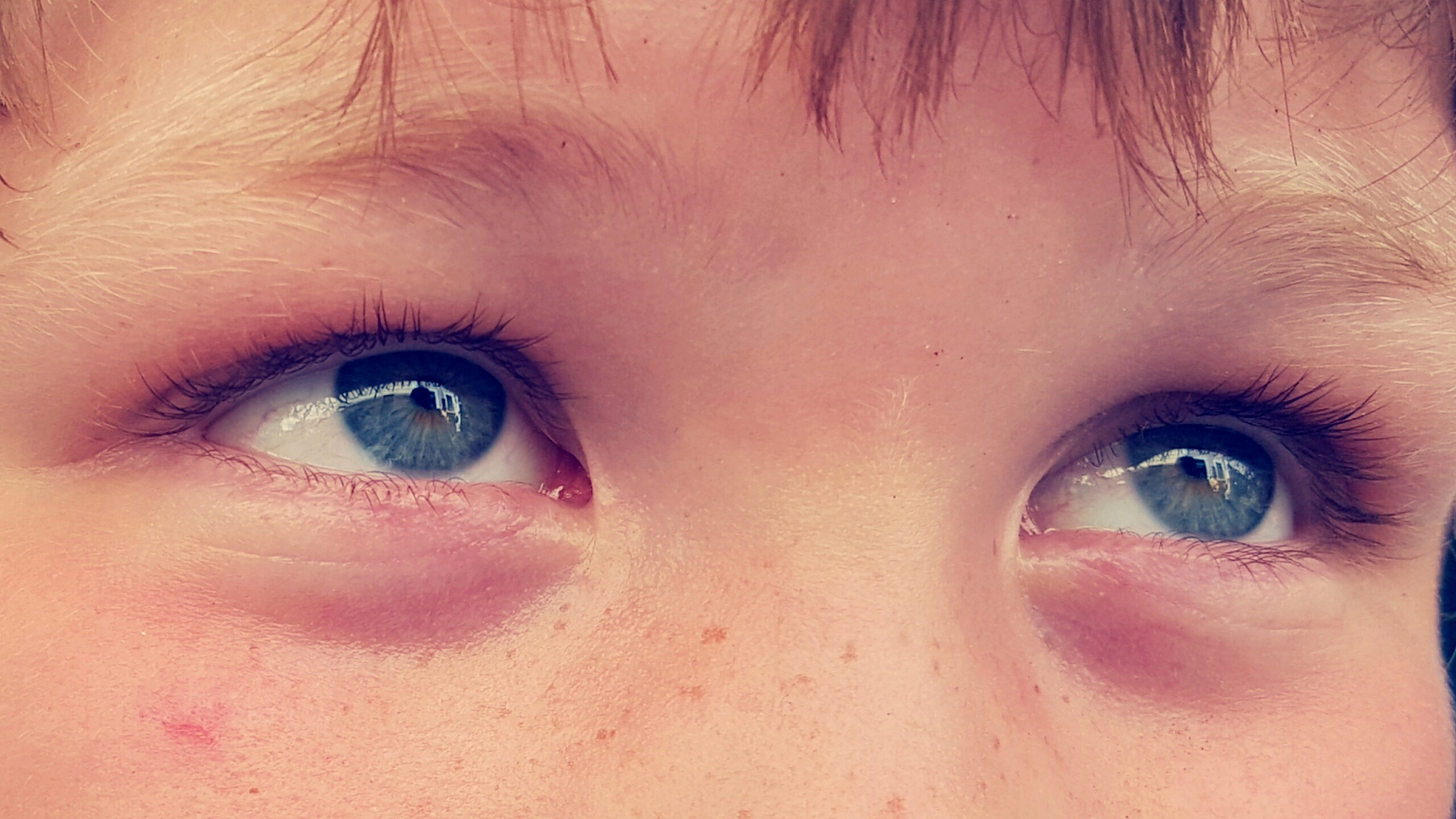 宝宝眼袋发紫图片图片
