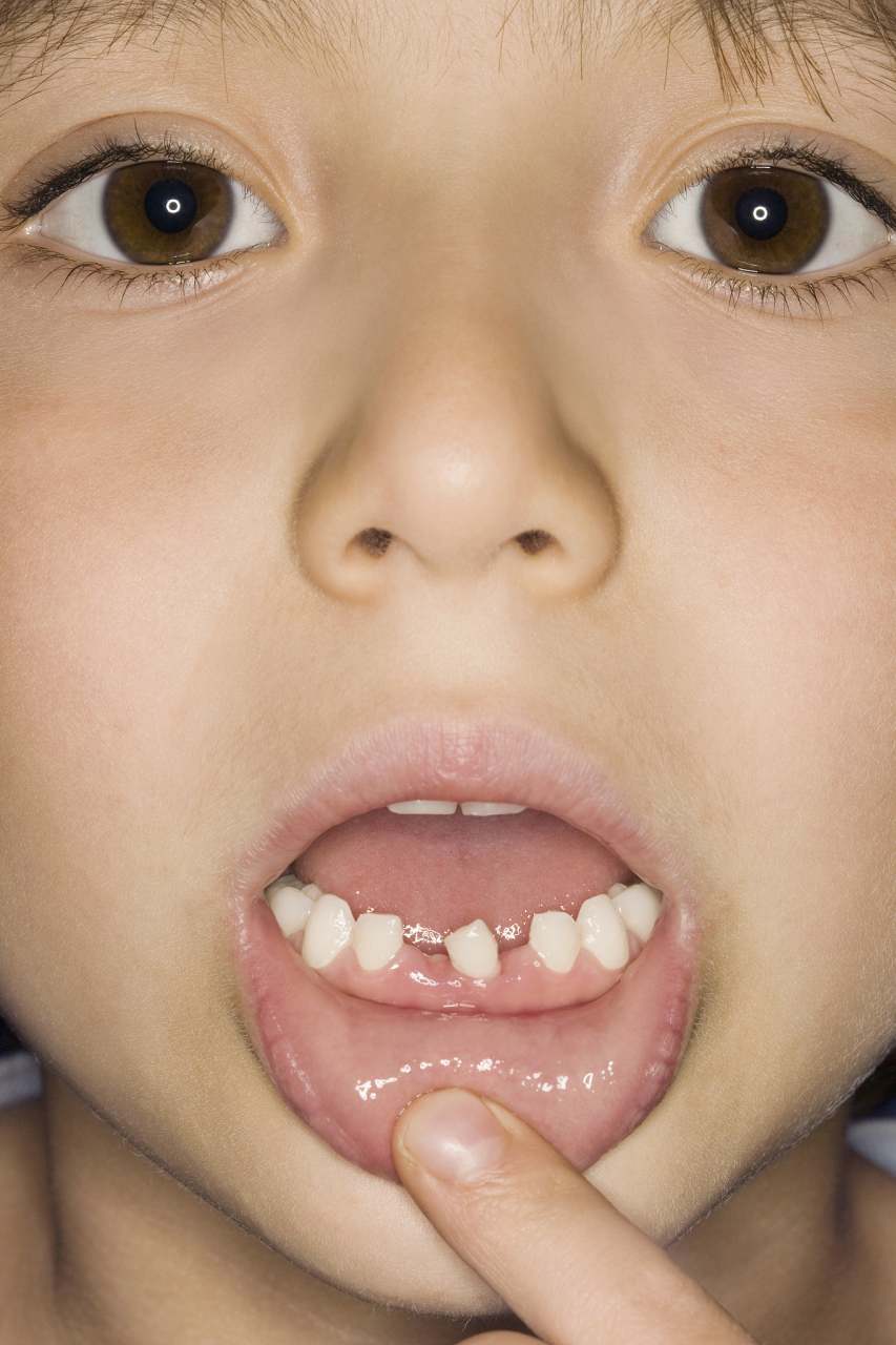 孩子长牙是一个非常重要的生长发育阶段,家长们需要注意许多问题.