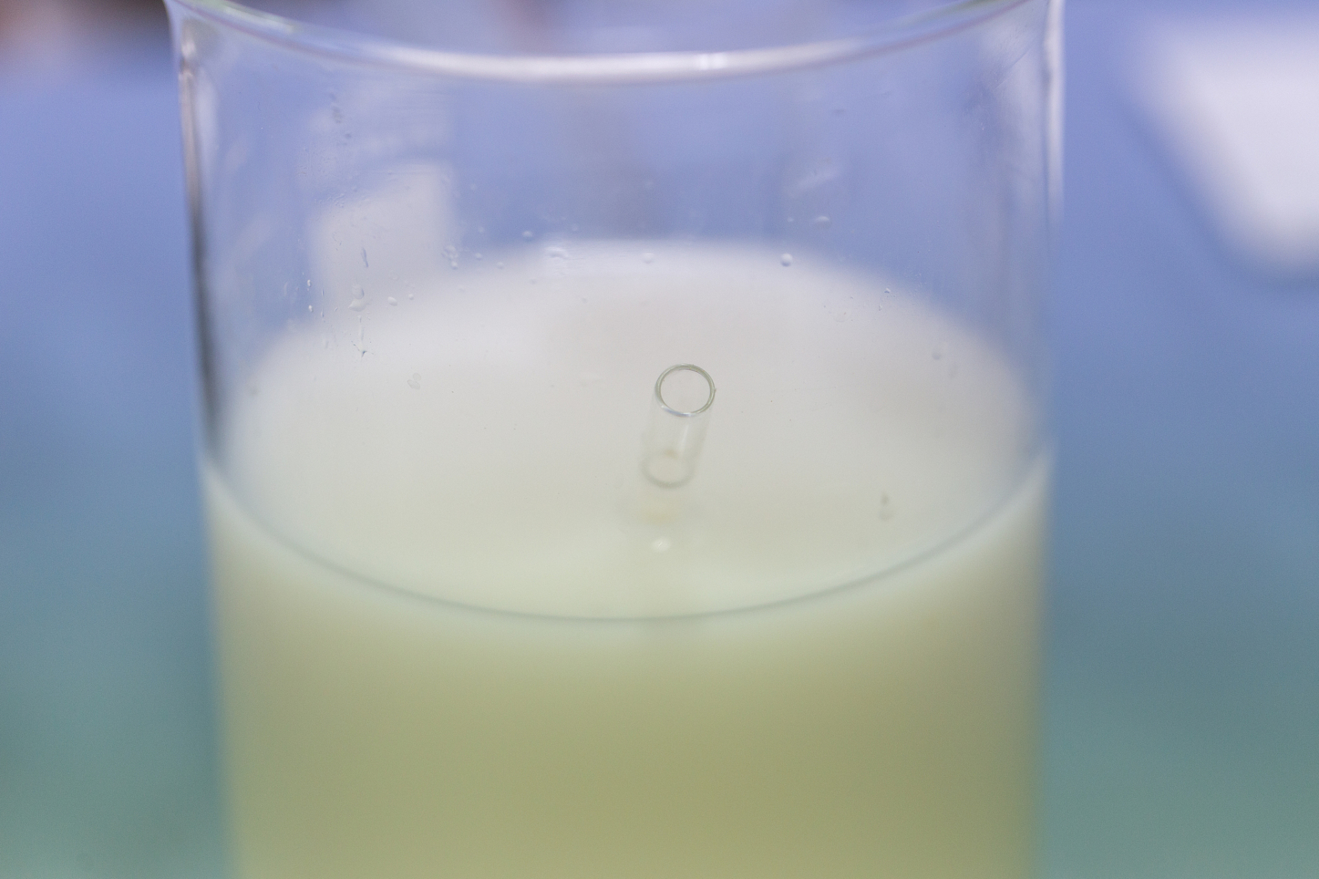 尿液乳白像豆浆怎么回事儿?