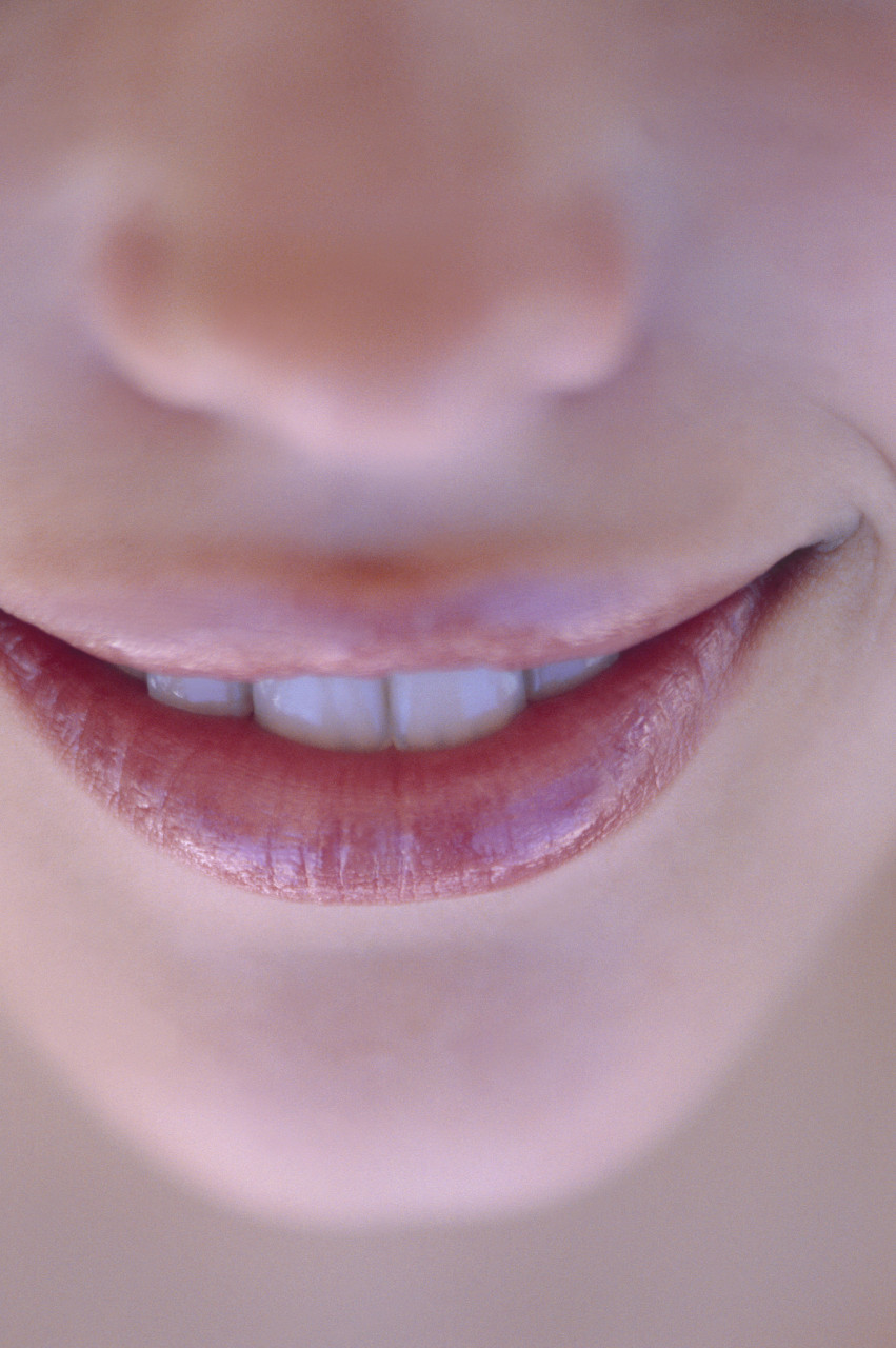 【患者自述】:在我小时候,父母就注意到我的上唇系带似乎比其他孩子短