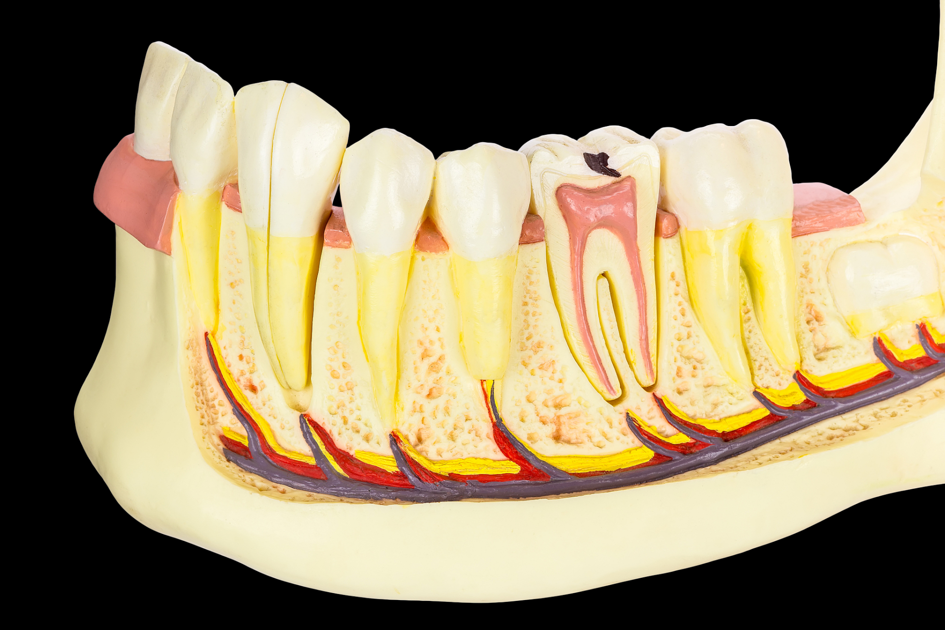 牙齿根部缺损怎么治疗	牙齿根部缺损的患者通常可以通过填充,洗牙