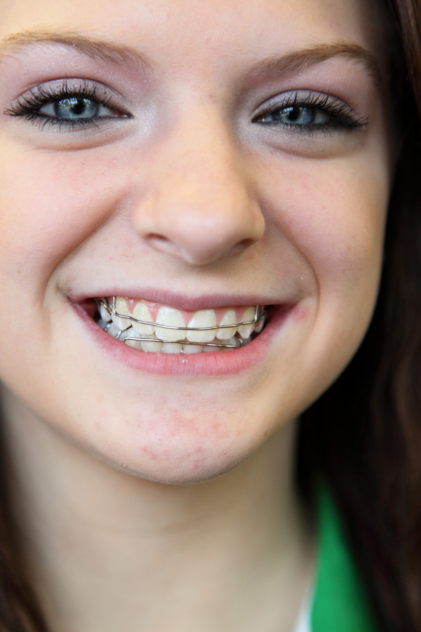 毕竟谁不想拥有一口整齐漂亮的牙齿呢?