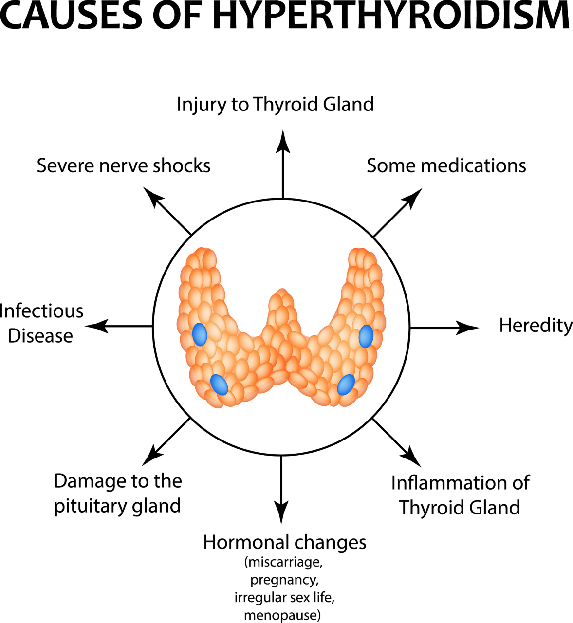 目前治疗甲亢的方式有以下4种:1.药物治疗.