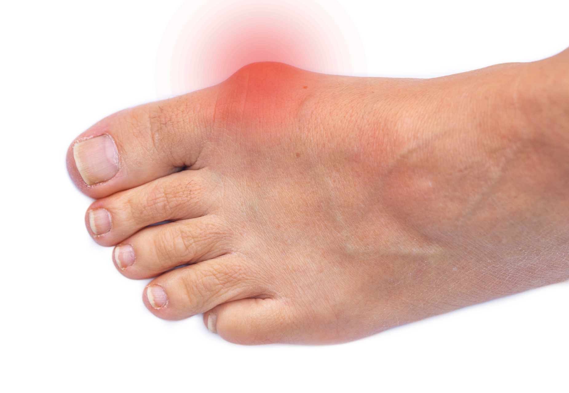 引起脚大拇指关节肿疼的原因很多,在临床比较多见的是以下几方面