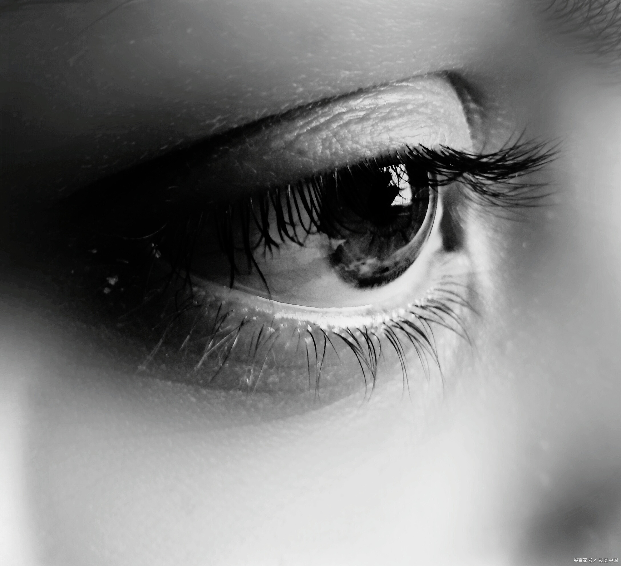 眼睛无缘无故流眼泪怎么缓解 明明没有难过或风沙刺激,眼睛却悄悄流泪