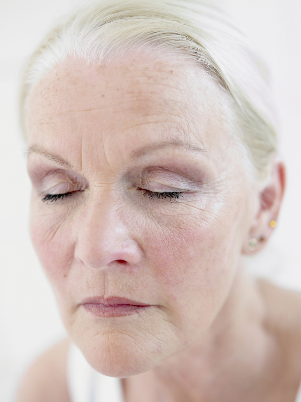 的方法  祛斑是一种常见的皮肤美容治疗方法,主要针对面部色斑问题