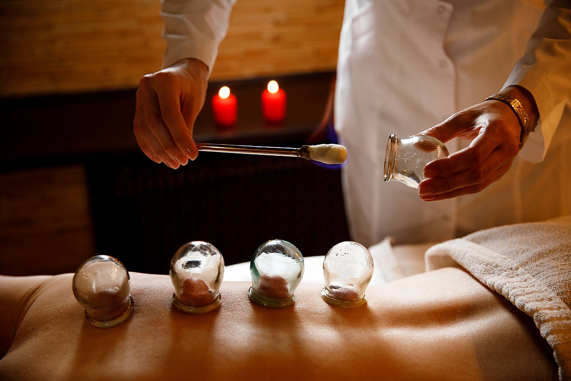 拔罐疗法是以罐具吸拔病变部位或穴位,使罐内形成负压吸住皮肤,以