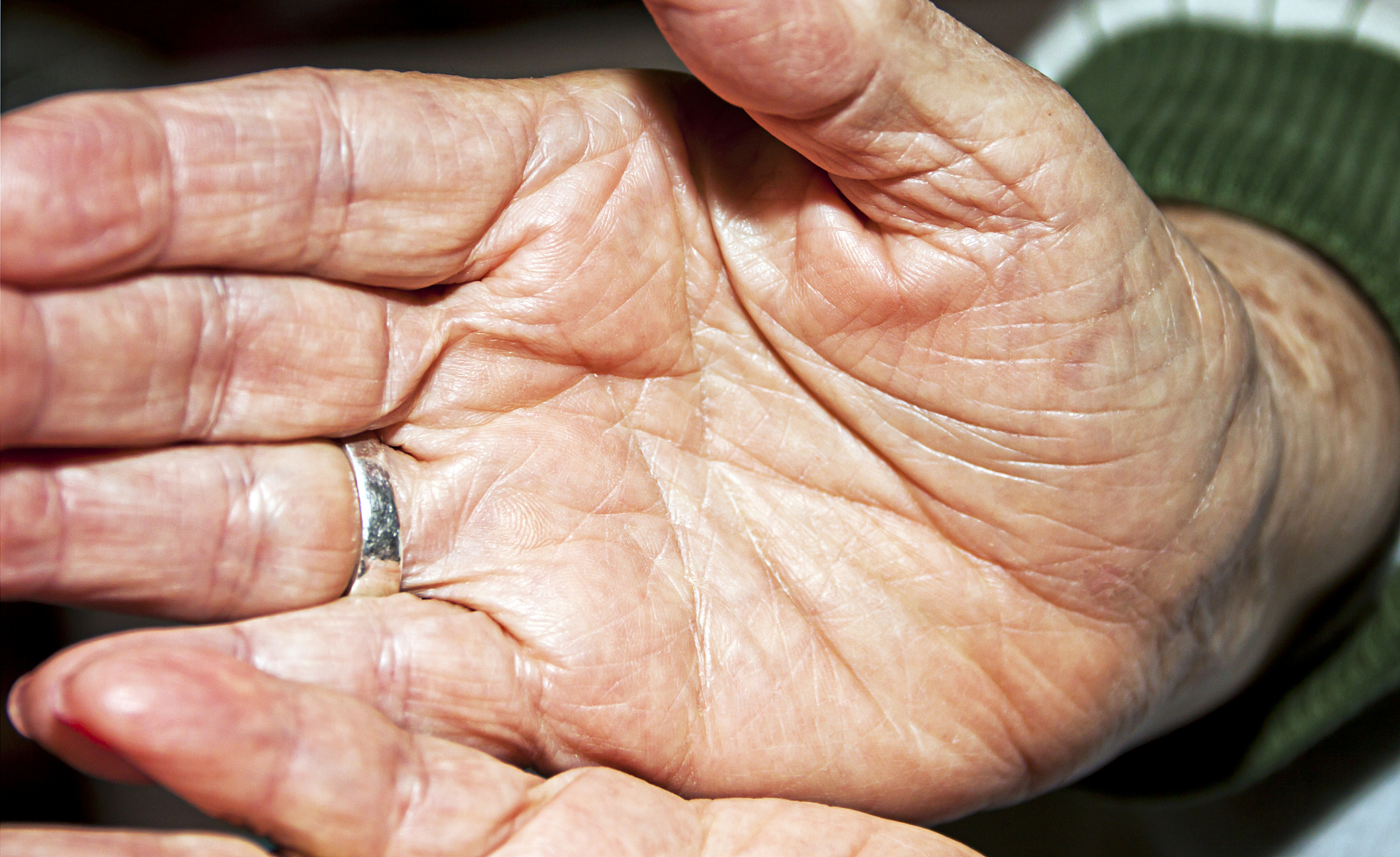 你不知道的美容日# 手皱纹多又粗糙怎么办?