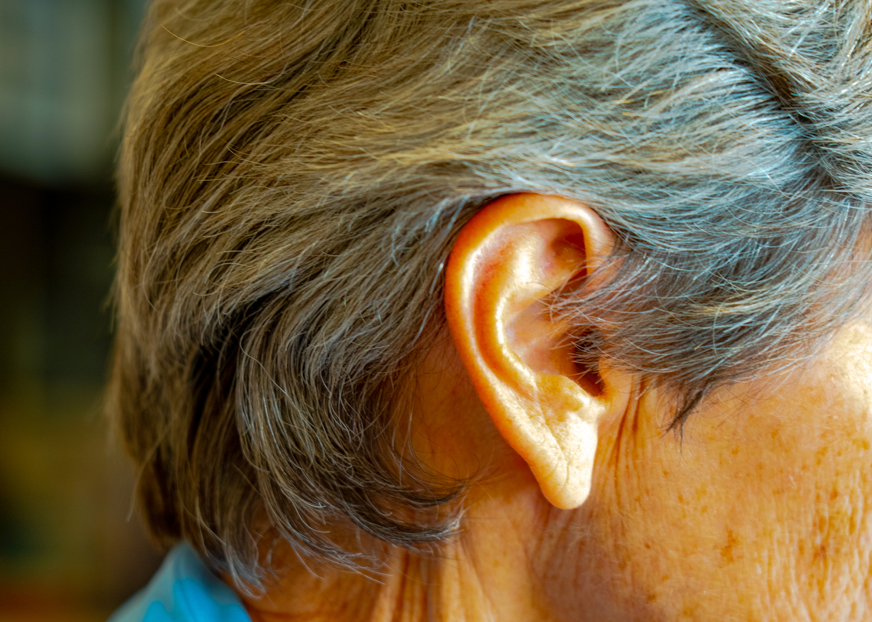 耳垂有褶皱,是冠心病的征兆吗  耳垂有褶皱并不是冠心病的特异性征兆