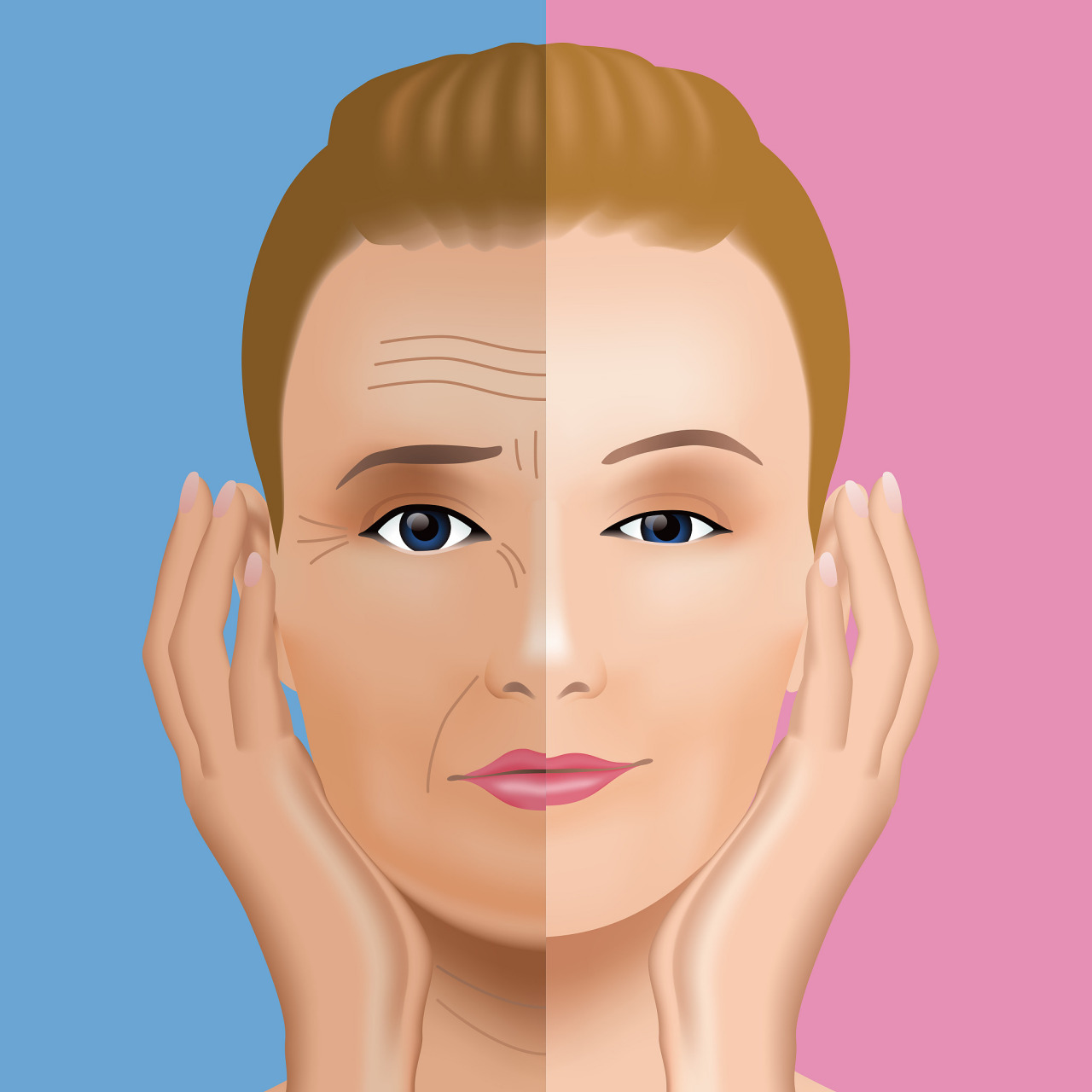 大拉皮手术到底拉了几层皮?